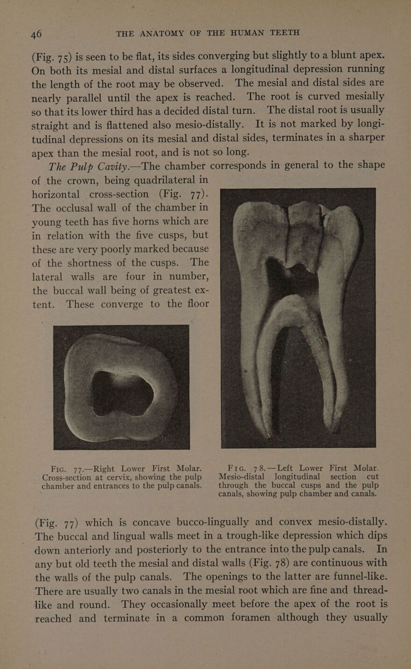 (Fig. 75) is seen to be flat, its sides converging but slightly to a blunt apex. On both its mesial and distal surfaces a longitudinal depression running the length of the root may be observed. The mesial and distal sides are nearly parallel until the apex is reached. The root is curved mesially so that its lower third has a decided distal turn. The distal root is usually straight and is flattened also mesio-distally. It is not marked by longi- tudinal depressions on its mesial and distal sides, terminates in a sharper apex than the mesial root, and is not so long. The Pulp Cavity—The chamber corresponds in general to the shape of the crown, being quadrilateral in horizontal cross-section (Fig. 77). The occlusal wall of the chamber in young teeth has five horns which are in relation with the five cusps, but these are very poorly marked because of the shortness of the cusps. The lateral walls are four in number, the buccal wall being of greatest ex- tent. These converge to the floor Fic. 77.—Right Lower First Molar. Fro. .78.—Left Lower First Molar. Cross-section at cervix, showing the pulp Mesio-distal longitudinal section cut chamber and entrances to the pulp canals. through the buccal cusps and the pulp canals, showing pulp chamber and canals. (Fig. 77) which is concave bucco-lingually and convex mesio-distally. The buccal and lingual walls meet in a trough-like depression which dips down anteriorly and posteriorly to the entrance into the pulp canals. In any but old teeth the mesial and distal walls (Fig. 78) are continuous with the walls of the pulp canals. The openings to the latter are funnel-like. There are usually two canals in the mesial root which are fine and thread- like and round. They occasionally meet before the apex of the root is reached and terminate in a common foramen although they usually