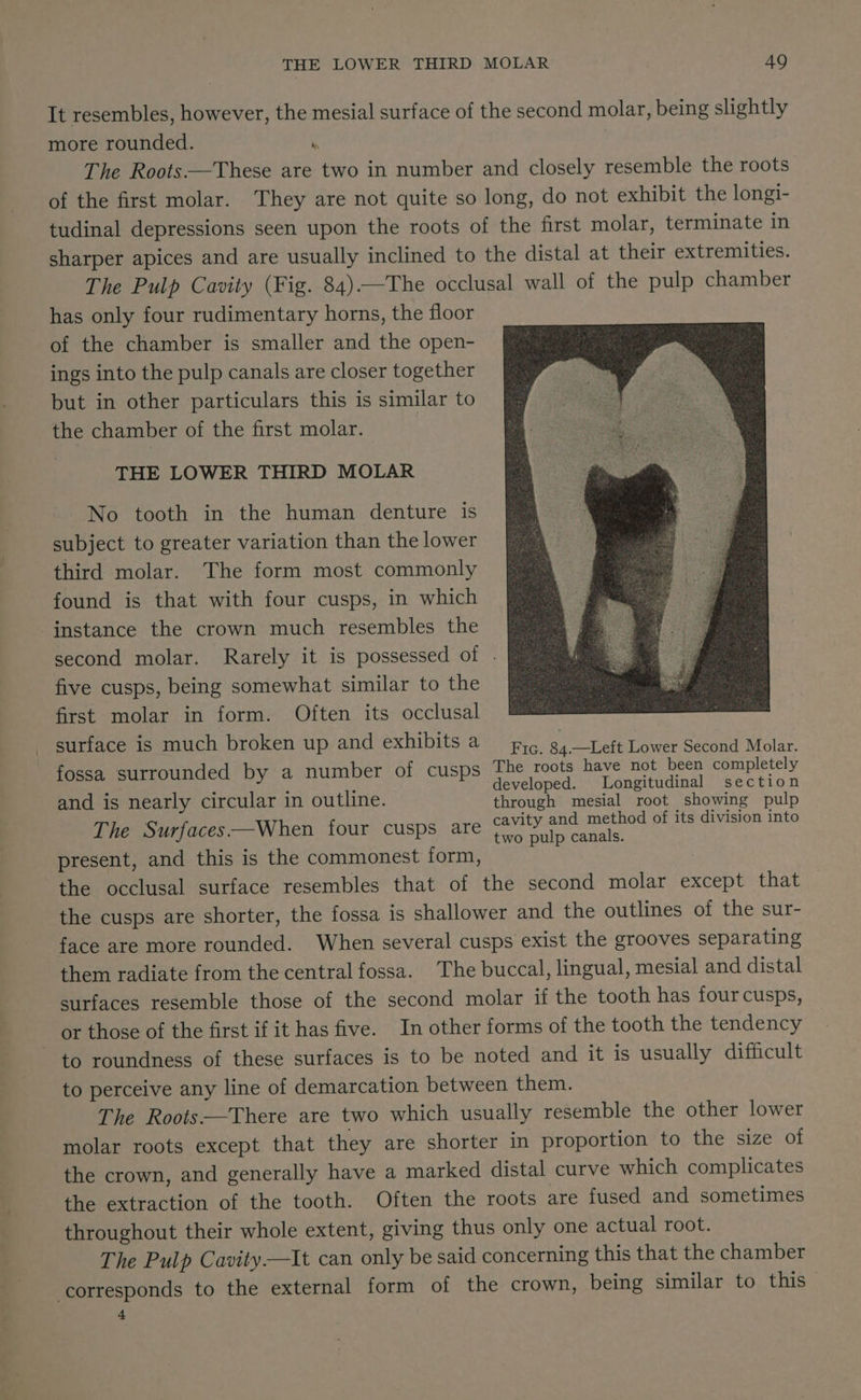 It resembles, however, the mesial surface of the second molar, being slightly more rounded. k The Roots—These are two in number and closely resemble the roots of the first molar. They are not quite so long, do not exhibit the longi- tudinal depressions seen upon the roots of the first molar, terminate in sharper apices and are usually inclined to the distal at their extremities. The Pulp Cavity (Fig. 84)——The occlusal wall of the pulp chamber has only four rudimentary horns, the floor of the chamber is smaller and the open- ings into the pulp canals are closer together but in other particulars this is similar to the chamber of the first molar. THE LOWER THIRD MOLAR No tooth in the human denture is subject to greater variation than the lower third molar. The form most commonly found is that with four cusps, in which instance the crown much resembles the second molar. Rarely it is possessed of . five cusps, being somewhat similar to the first molar in form. Often its occlusal surface is much broken up and exhibits a pug. 8, -Teft ara eee eile fossa surrounded by a number of cusps The roots have not been completely , : d ; developed. Longitudinal section and is nearly circular in outline. through mesial root showing pulp The Surfaces —When four cusps are Sie a ae of its division into wo pulp canals. present, and this is the commonest form, the occlusal surface resembles that of the second molar except that the cusps are shorter, the fossa is shallower and the outlines of the sur- face are more rounded. When several cusps exist the grooves separating them radiate from the central fossa. The buccal, lingual, mesial and distal surfaces resemble those of the second molar if the tooth has fourcusps, or those of the first if it has five. In other forms of the tooth the tendency to roundness of these surfaces is to be noted and it is usually difficult to perceive any line of demarcation between them. The Roots——There are two which usually resemble the other lower molar roots except that they are shorter in proportion to the size of the crown, and generally have a marked distal curve which complicates the extraction of the tooth. Often the roots are fused and sometimes throughout their whole extent, giving thus only one actual root. The Pulp Cavity—It can only be said concerning this that the chamber ‘corresponds to the external form of the crown, being similar to this 4