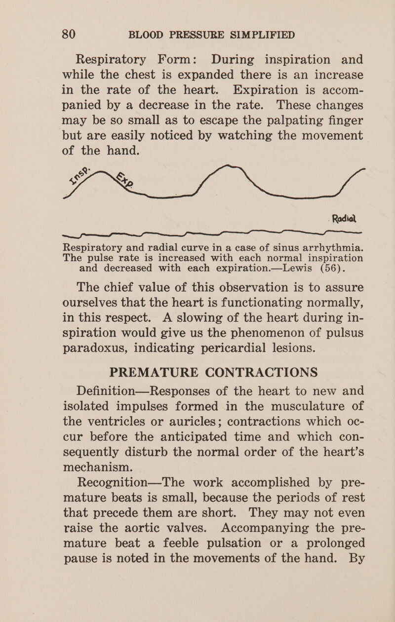 Respiratory Form: During inspiration and while the chest is expanded there is an increase in the rate of the heart. Expiration is accom- panied by a decrease in the rate. These changes may be so small as to escape the palpating finger but are easily noticed by watching the movement of the hand. se &amp;, - Radial a a a i Respiratory and radial curve in a case of sinus arrhythmia. The pulse rate is increased with each normal inspiration and decreased with each expiration.—Lewis (56). The chief value of this observation is to assure ourselves that the heart is functionating normally, in this respect. A slowing of the heart during in- spiration would give us the phenomenon of pulsus paradoxus, indicating pericardial lesions. PREMATURE CONTRACTIONS Definition—Responses of the heart to new and isolated impulses formed in the musculature of the ventricles or auricles; contractions which oc- cur before the anticipated time and which con- sequently disturb the normal order of the heart’s mechanism. Recognition—The work accomplished by pre- mature beats is small, because the periods of rest that precede them are short. They may not even raise the aortic valves. Accompanying the pre- mature beat a feeble pulsation or a prolonged pause is noted in the movements of the hand. By