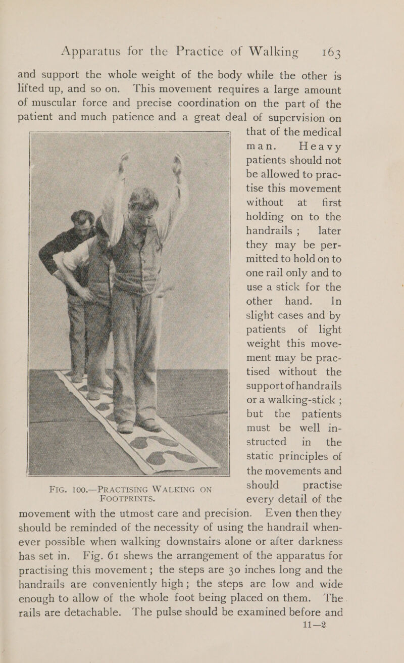 and support the whole weight of the body while the other is lifted up, and so on. This movement requires a large amount of muscular force and precise coordination on the part of the patient and much patience and a great deal of supervision on Ä that of the medical man. Heavy patients should not be allowed to prac- tise this movement without at first holding on to the handrails ; later they may be per- mitted to hold on to one rail only and to use a stick for the other hand. In slight cases and by patients of light weight this move- ment may be prac- tised without the support of handrails or a walking-stick ; but the patients must be well in- structed in the static principles of the movements and FIG. 100.—PRACTISING WALKING ON should Bu FOOTPRINTS. every detail of the movement with the utmost care and precision. Even then they should be reminded of the necessity of using the handrail when- ever possible when walking downstairs alone or after darkness has set in. Fig. 61 shews the arrangement of the apparatus for practising this movement; the steps are 30 inches long and the handrails are conveniently high; the steps are low and wide enough to allow of the whole foot being placed on them. The. rails are detachable. The pulse should be examined before and 11—2