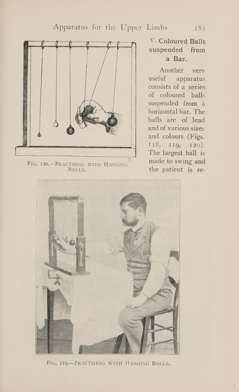 194 FIG. 120.—PRACTISING WITH HANGING BALES. V. Coloured Balls suspended from a Bar. Another very useful apparatus consists of a series of coloured balls suspended from a horizontal bar. The balls are of lead and of various sizes and colours (Figs. 118,1 Opa 13.0) The largest ball is made to swing and the patient is re-