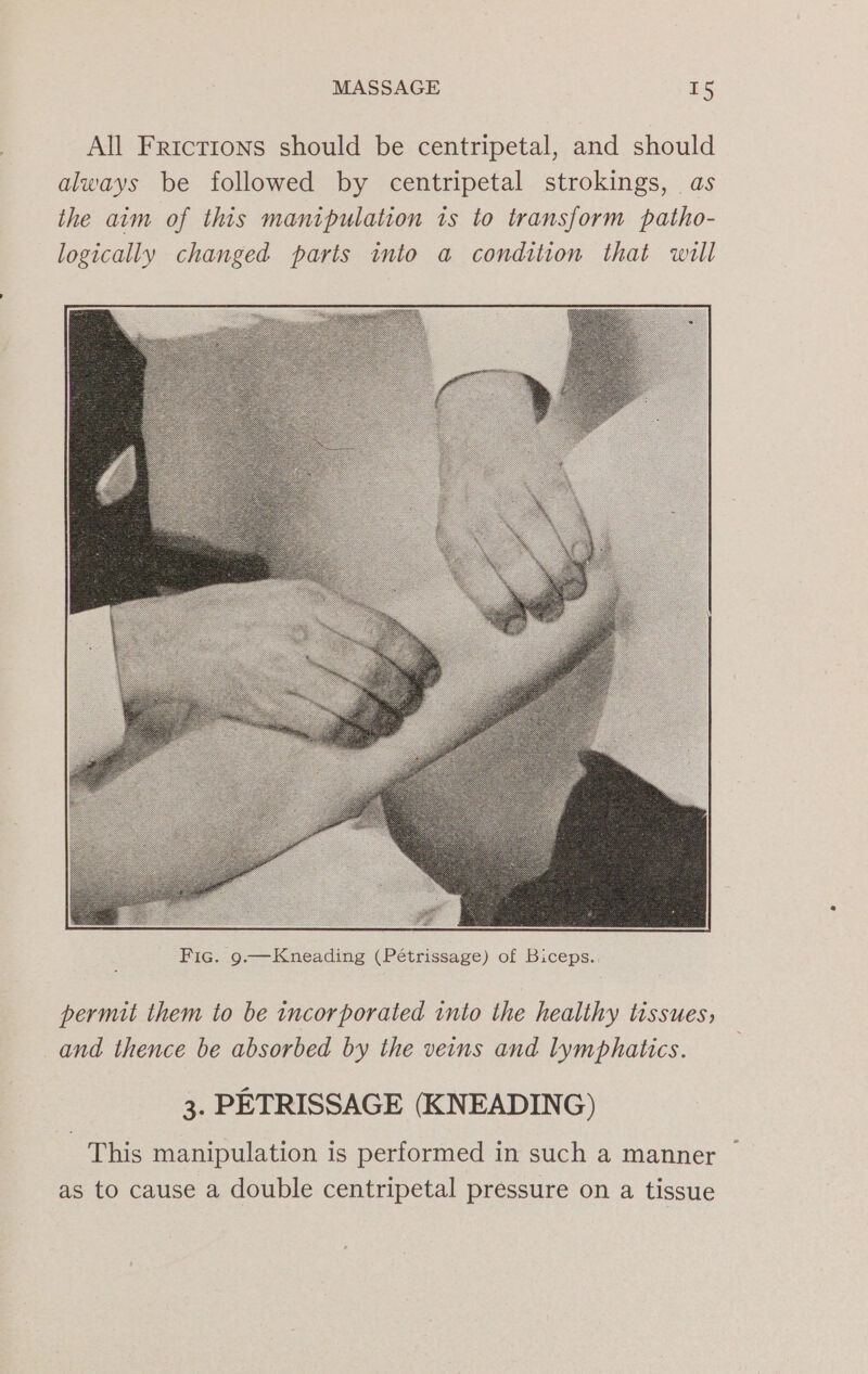 All Frictions should be centripetal, and should always be followed by centripetal strokings, as the aim of this manipulation is to transform patho- logically changed parts into a condition that will permit them to be incorporated into the healthy tissues, and thence be absorbed by the veins and lymphatics. 3. PETRISSAGE (KNEADING) This manipulation is performed in such a manner as to cause a double centripetal pressure on a tissue °