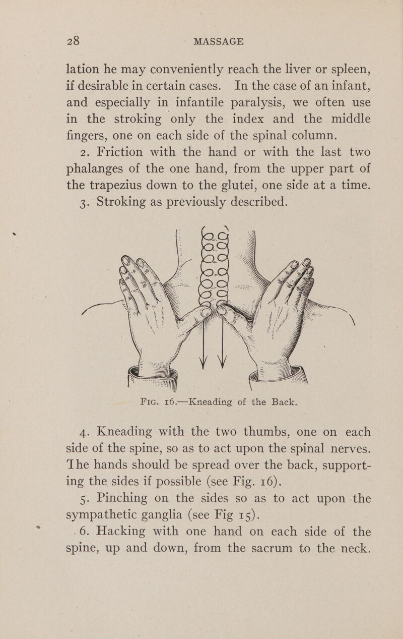 lation he may conveniently reach the liver or spleen, if desirable in certain cases. In the case of an infant, and especially in infantile paralysis, we often use in the stroking only the index and the middle fingers, one on each side of the spinal column. 2. Friction with the hand or with the last two phalanges of the one hand, from the upper part of the trapezius down to the glutei, one side at a time. 3. Stroking as previously described. ate | Fic. 16.—Kneading of the Back. 4. Kneading with the two thumbs, one on each side of the spine, so as to act upon the spinal nerves. The hands should be spread over the back, support- ing the sides if possible (see Fig. 16). 5. Pinching on the sides so as to act upon the sympathetic ganglia (see Fig 15). .6. Hacking with one hand on each side of the spine, up and down, from the sacrum to the neck.
