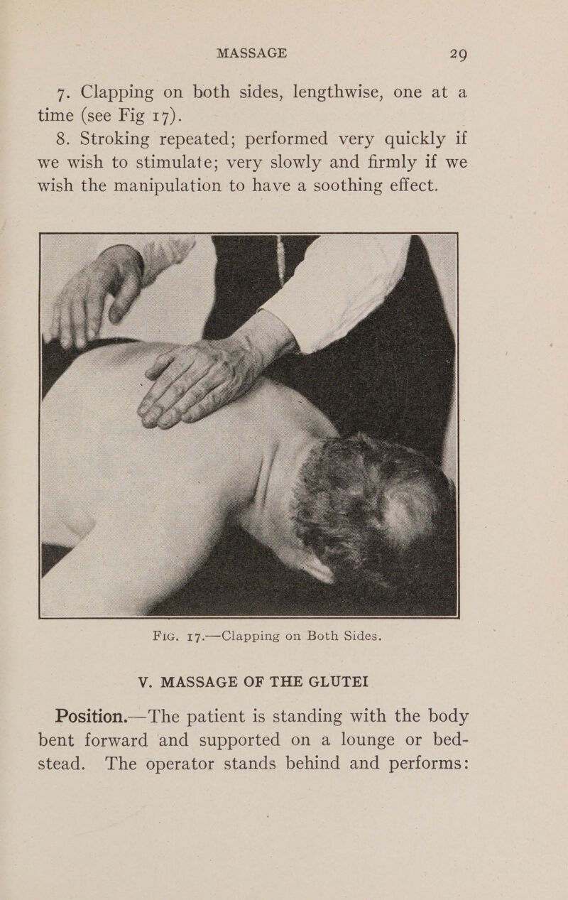 7. Clapping on both sides, lengthwise, one at a time (see Fig 17). 8. Stroking repeated; performed very quickly if we wish to stimulate; very slowly and firmly if we wish the manipulation to have a soothing effect. V. MASSAGE OF THE GLUTEI Position.—The patient is standing with the body bent forward and supported on a lounge or bed- stead. The operator stands behind and performs: