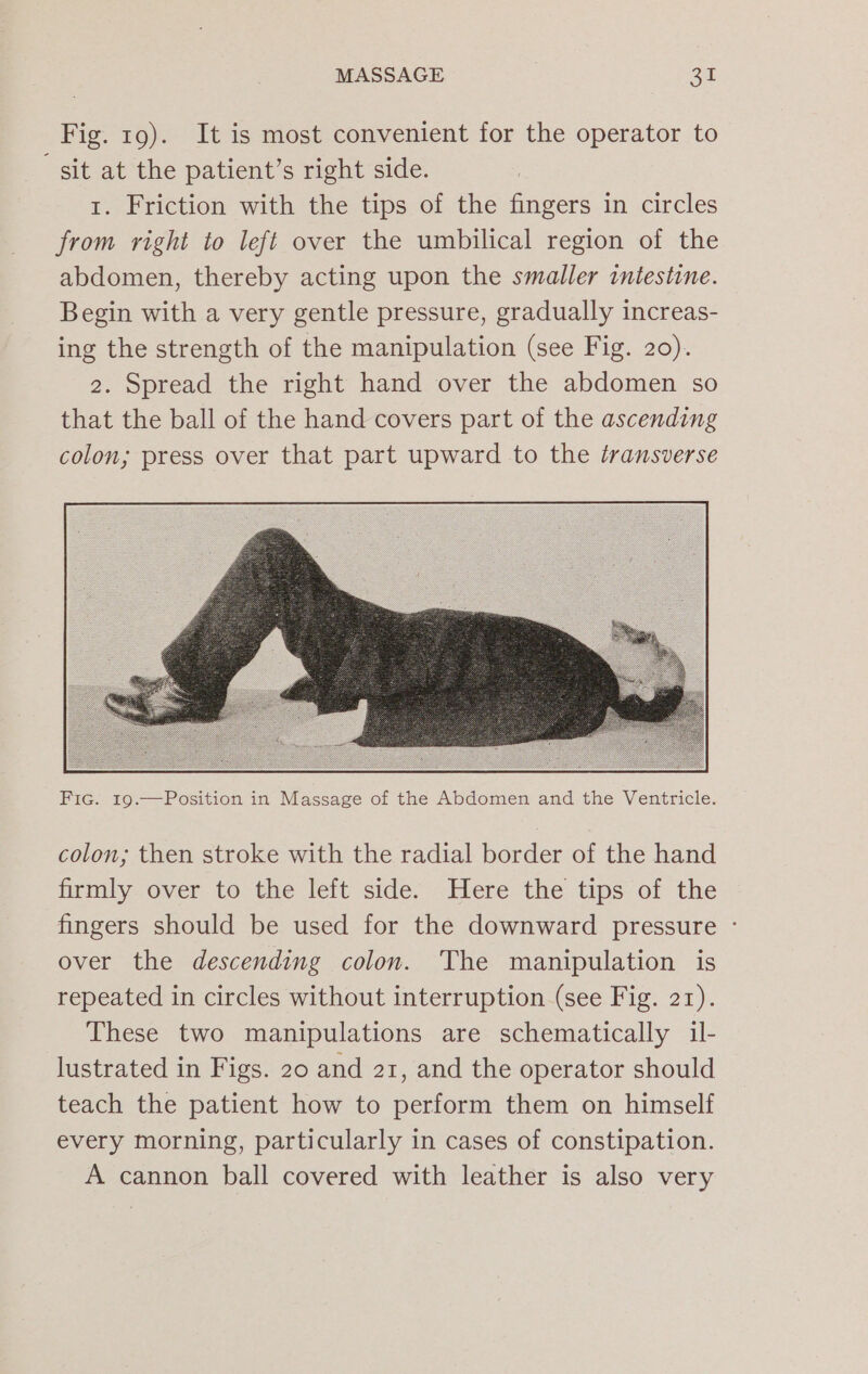 Fig. 19). It is most convenient for the operator to sit at the patient’s right side. 1. Friction with the tips of the fingers in circles from right to left over the umbilical region of the abdomen, thereby acting upon the smaller intestine. Begin with a very gentle pressure, gradually increas- ing the strength of the manipulation (see Fig. 20). 2. Spread the right hand over the abdomen so that the ball of the hand covers part of the ascending colon; press over that part upward to the transverse Fic. 19.—Position in Massage of the Abdomen and the Ventricle. colon; then stroke with the radial border of the hand firmly over to the left side. Here the tips of the fingers should be used for the downward pressure - over the descending colon. The manipulation is repeated in circles without interruption (see Fig. 21). These two manipulations are schematically il- lustrated in Figs. 20 and 21, and the operator should teach the patient how to perform them on himself every morning, particularly in cases of constipation. A cannon ball covered with leather is also very
