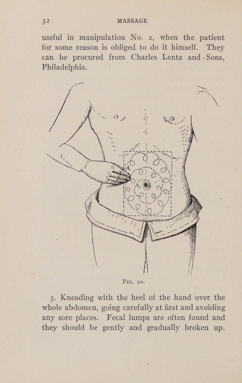 useful in manipulation No. 2, when the patient for some reason is obliged to do it himself. They can be procured from Charles Lentz and -Sons, Philadelphia. 3. Kneading with the heel of the hand over the whole abdomen, going carefully at first and avoiding any sore places. Fecal lumps are often found and they should be gently and gradually broken up.