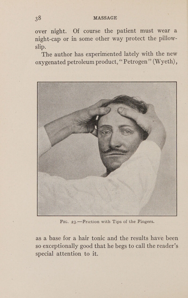 over night. Of course the patient must wear a night-cap or in some other way protect the pillow- slip. The author has experimented lately with the new oxygenated petroleum product, ‘‘ Petrogen” (Wyeth), as a base for a hair tonic and the results have been so exceptionally good that he begs to call the reader’s special attention to it.