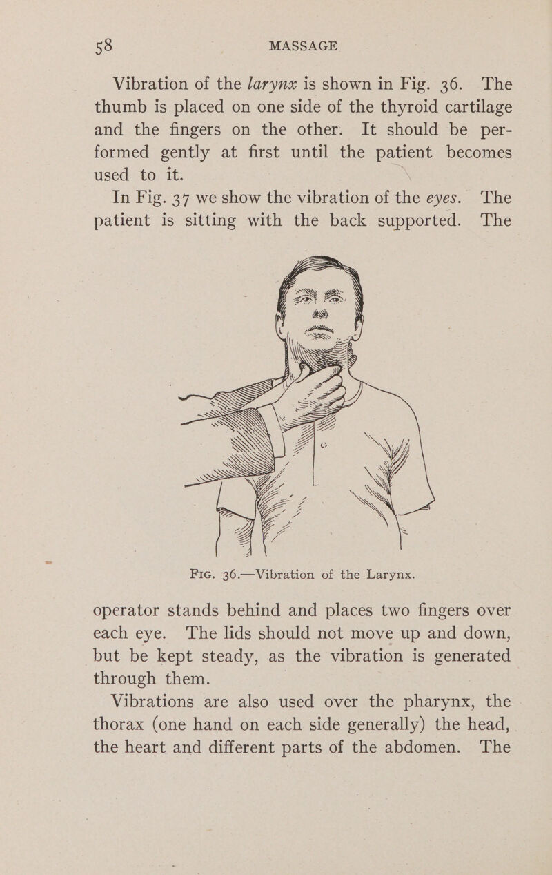 Vibration of the /arynx is shown in Fig. 36. The thumb is placed on one side of the thyroid cartilage and the fingers on the other. It should be per- formed gently at first until the patient becomes used to it. &gt; In Fig. 37 we show the vibration of the eyes. The patient is sitting with the back supported. The operator stands behind and places two fingers over each eye. ‘The lids should not move up and down, but be kept steady, as the vibration is generated through them. | Vibrations are also used over the pharynx, the thorax (one hand on each side generally) the head, the heart and different parts of the abdomen. The