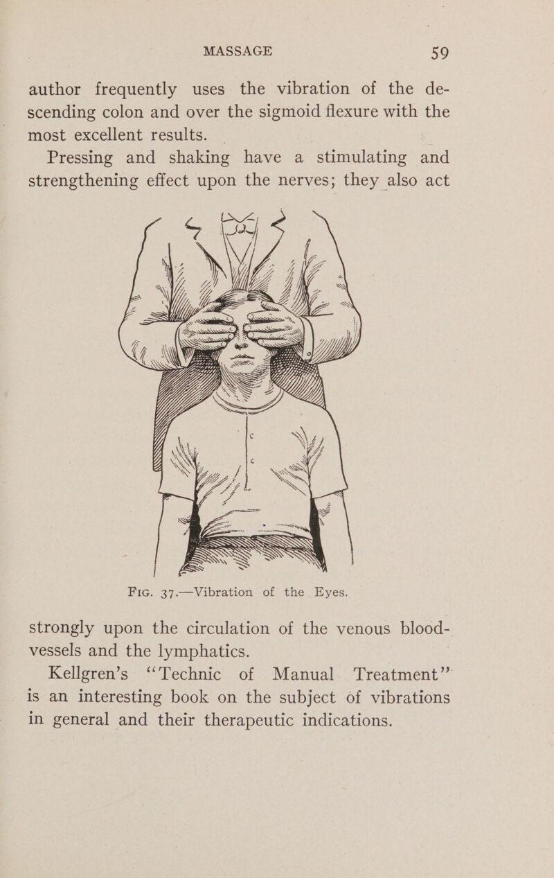 author frequently uses the vibration of the de- scending colon and over the sigmoid flexure with the most excellent results. i Pressing and shaking have a stimulating and strengthening effect upon the nerves; they also act strongly upon the circulation of the venous blood- vessels and the lymphatics. Kellgren’s ‘‘Technic of Manual Treatment’”’ is an interesting book on the subject of vibrations in general and their therapeutic indications.