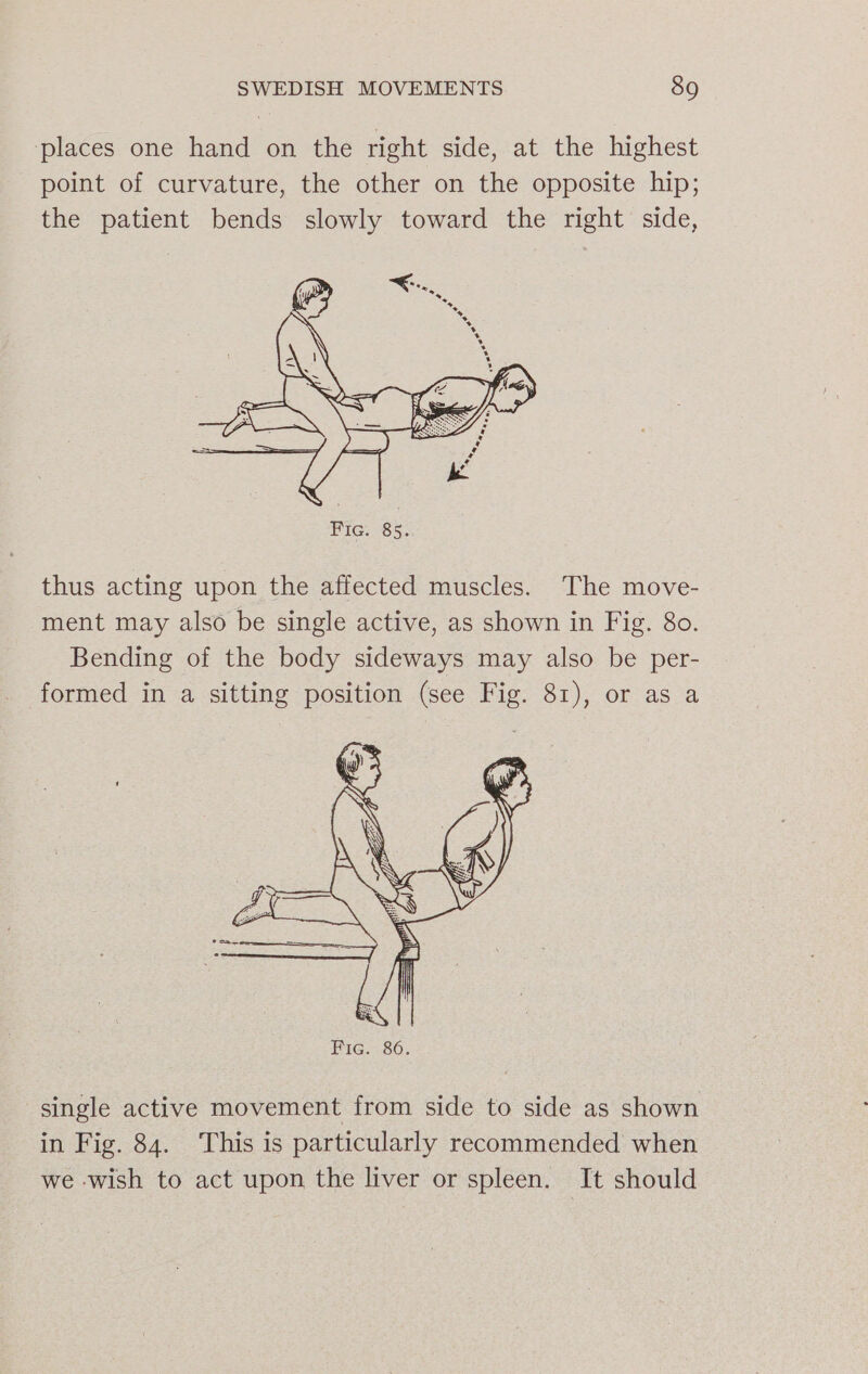 ‘places one hand on the right side, at the highest point of curvature, the other on the opposite hip; the patient bends slowly toward the right side, thus acting upon the affected muscles. The move- ment may also be single active, as shown in Fig. 80. Bending of the body sideways may also be per- formed in a sitting position (see Fig. 81), or as a single active movement from side to side as shown in Fig. 84. This is particularly recommended when we wish to act upon the liver or spleen. It should
