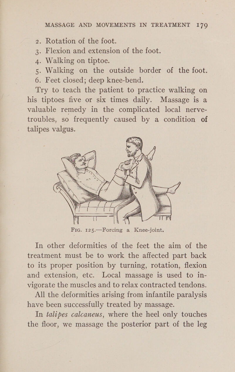 . Rotation of the foot. . Flexion and extension of the foot. . Walking on tiptoe. . Walking on the outside border of the foot. . Feet closed; deep knee-bend. Try to teach the patient to practice walking on his tiptoes five or six times daily. Massage is a valuable remedy in the complicated local nerve- troubles, so frequently caused by a condition of talipes valgus. Ot —&amp; © bd In other deformities of the feet the aim of the treatment must be to work the affected part back to its proper position by turning, rotation, flexion and extension, etc. Local massage is used to in- vigorate the muscles and to relax contracted tendons. All the deformities arising from infantile paralysis have been successfully treated by massage. In talipes calcaneus, where the heel only touches the floor, we massage the posterior part of the leg