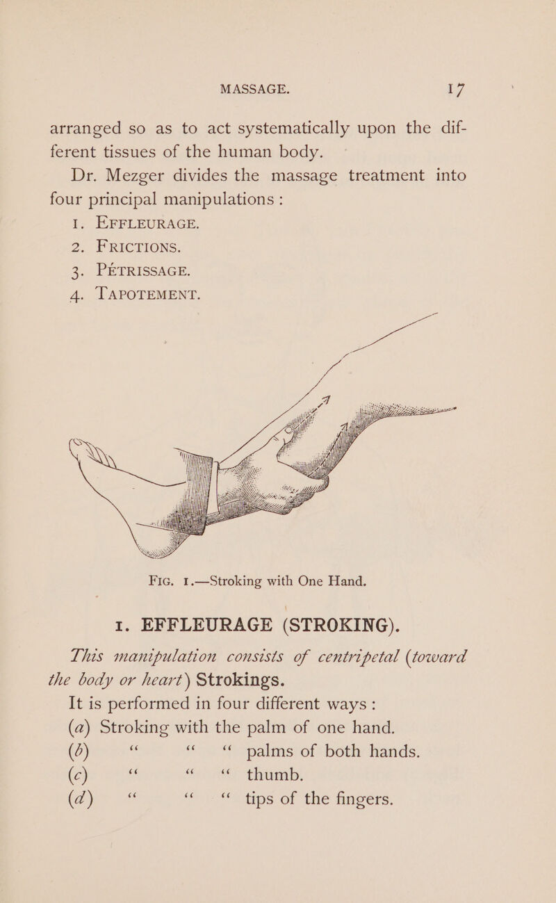 . LAPOTEMENT. Fic. 1.—Stroking with One Hand. 1. EFFLEURAGE (STROKING). This manipulation consists of centripetal (toward the body or heart) Strokings. It is performed in four different ways : (2) Stroking with the palm of one hand. (0) ss «© «palms of both hands. (c) st Hes 86” twa, C2 ae i “ots of tae ingers,