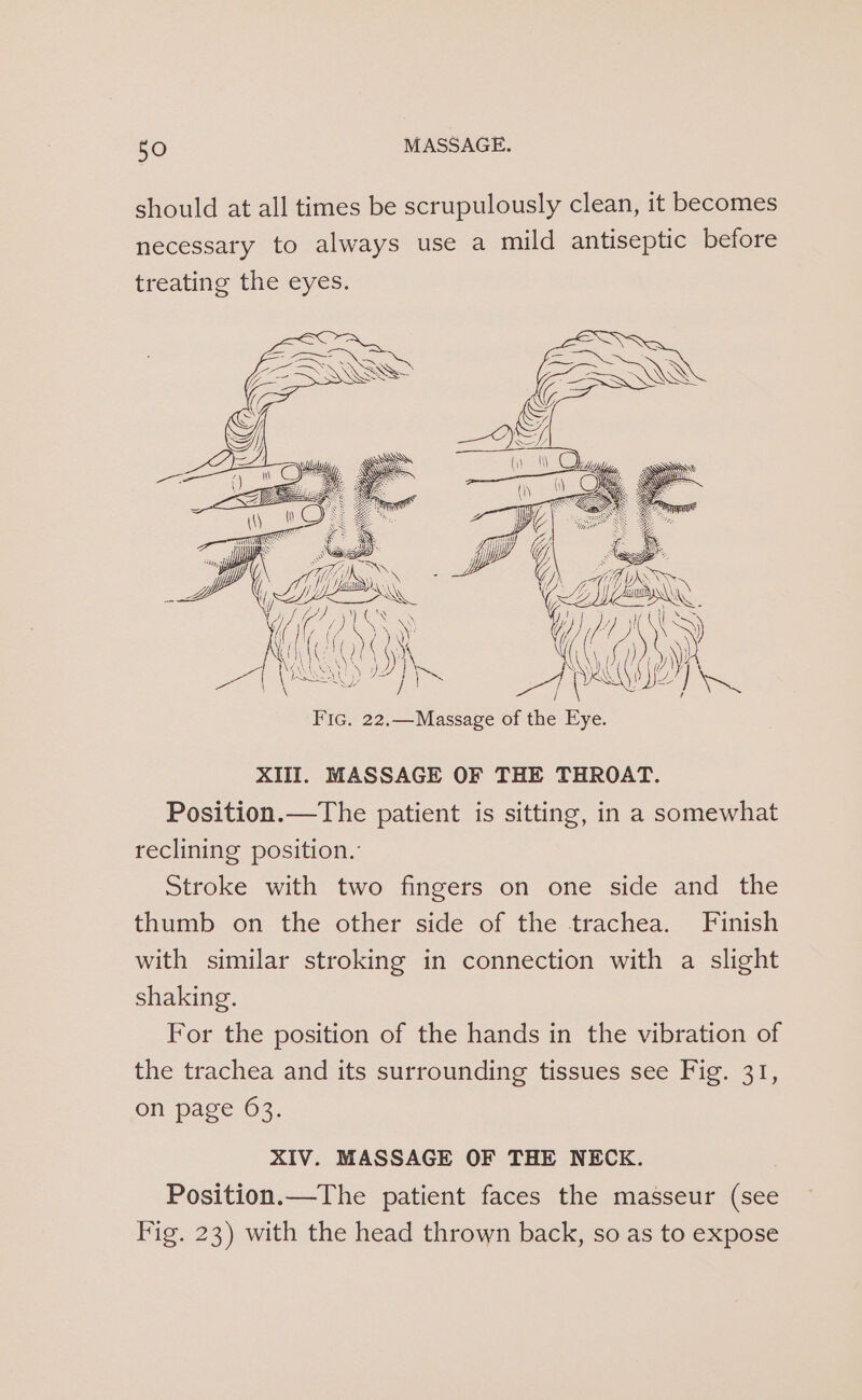 should at all times be scrupulously clean, it becomes necessary to always use a mild antiseptic before treating the eyes. mae” Me ; HS (\\ OR ae (1) \ We Z ~ > z es = ‘ Be hy} (Si ne Bi, Fic. 22,—Massage es a ie Tl 4 gs yy XIII. MASSAGE OF THE THROAT. Position.—The patient is sitting, in a somewhat reclining position.’ Stroke with two fingers on one side and the thumb on the other side of the trachea. Finish with similar stroking in connection with a slight shaking. For the position of the hands in the vibration of the trachea and its surrounding tissues see Fig. 31, on page 63. XIV. MASSAGE OF THE NECK. Position.—The patient faces the masseur (see Fig. 23) with the head thrown back, so as to expose