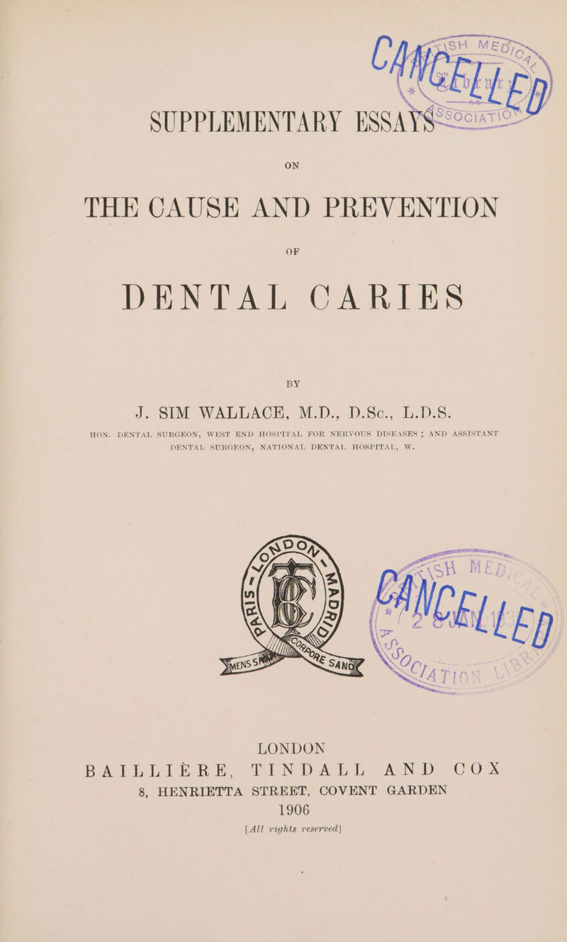 ON THE CAUSE AND PREVENTION OF DENTAL CARIES BY J. SIM WALLACE, M.D., D.Sc., L.D.S. WEST END HOSPITAL FOR NERVOUS DISEASES ; AND ASSISTANT ‘TAL HOSPITAL, W HON. DENTAL SURGEON, WES i} DENTAL SURGEON, NATIONAL DENTAL HOSPITAL, W t »\S pa ate c y /B a o &amp; UI OX ON : ‘| wy . Tensor esangp LONDON BALLLIERSL, TINDALL AND, COX 8, HENRIETTA STREET, COVENT GARDEN 1906 [All rights reserved)