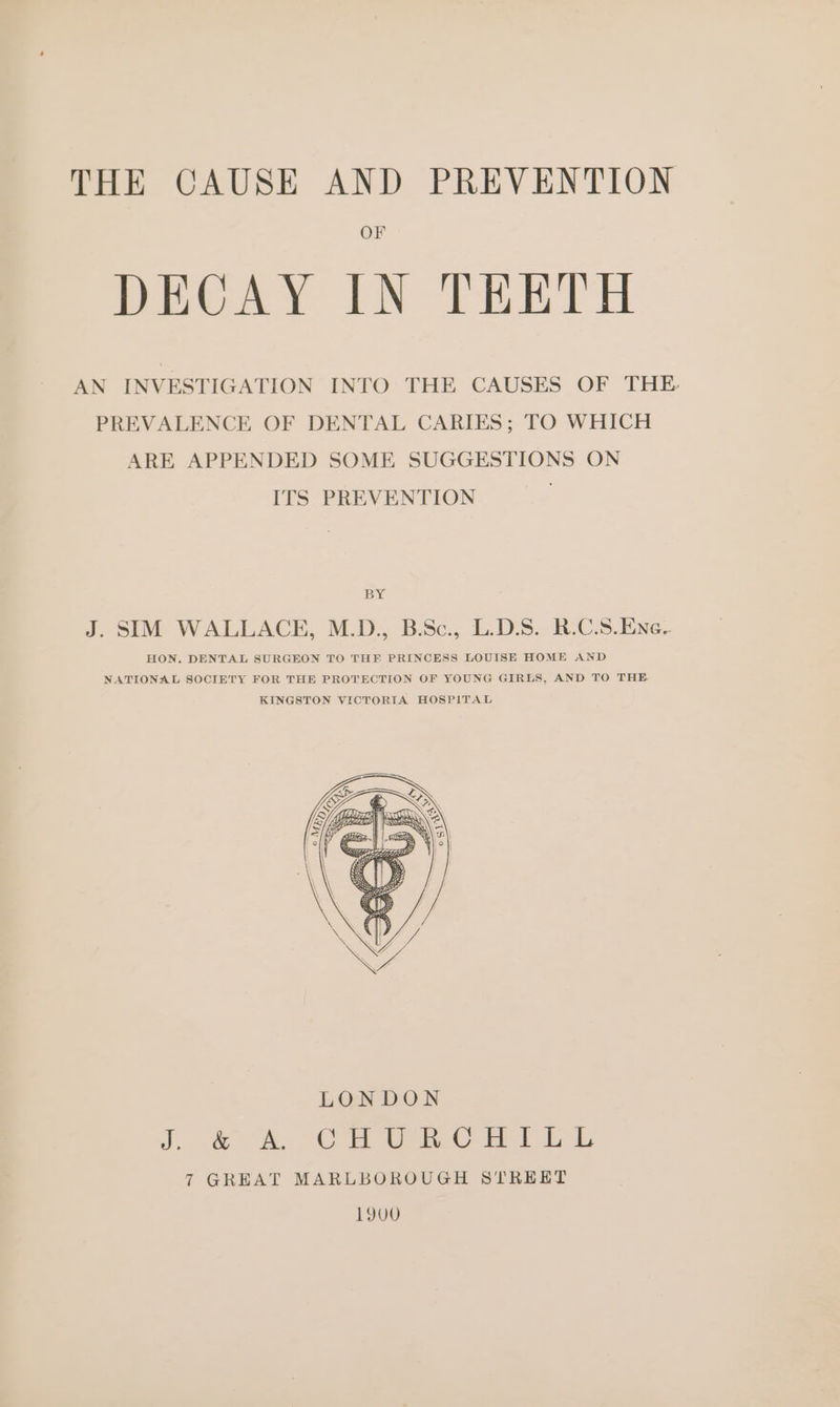 DECAY IN TEETH AN INVESTIGATION INTO: THE CAUSES OF THE. PREVALENCE OF DENTAL CARIES; TO WHICH ARE APPENDED SOME SUGGESTIONS ON ITS PREVENTION BY J. SIM WALLACE, M.D., B.Sc., L.D.S. R.C.S.Ene- HON. DENTAL SURGEON TO THE PRINCESS LOUISE HOME AND NATIONAL SOCIETY FOR THE PROTECTION OF YOUNG GIRLS, AND TO THE KINGSTON VICTORIA HOSPITAL