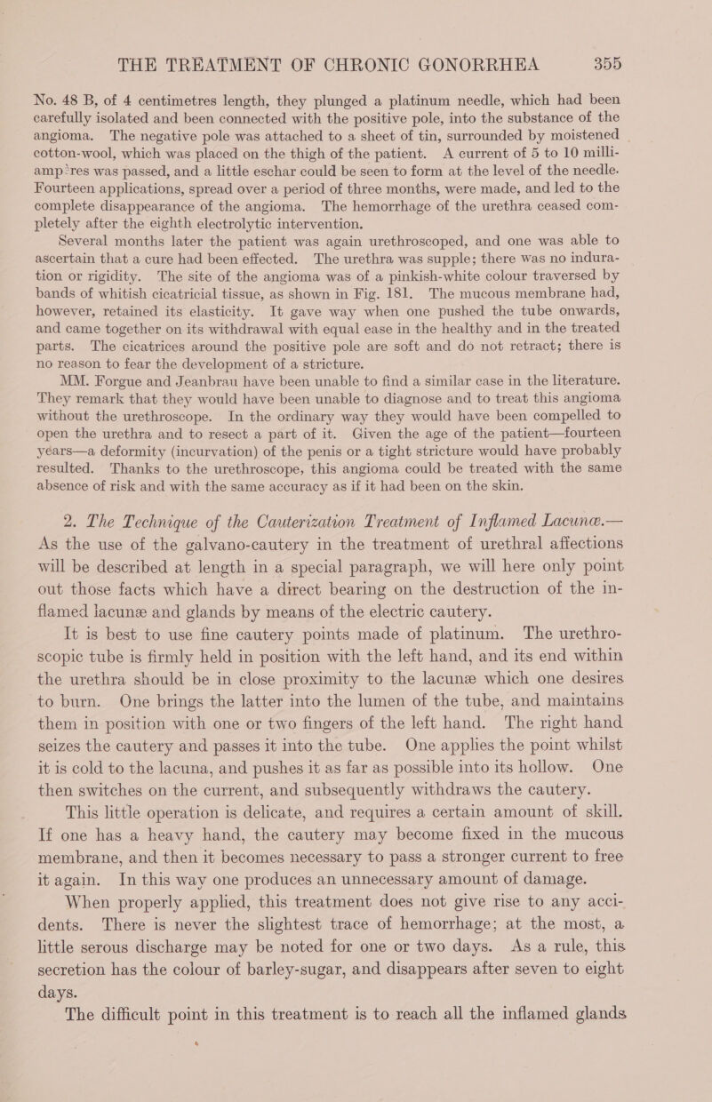 No. 48 B, of 4 centimetres length, they plunged a platinum needle, which had been carefully isolated and been connected with the positive pole, into the substance of the angioma. The negative pole was attached to a sheet of tin, surrounded by moistened _ cotton-wool, which was placed on the thigh of the patient. A current of 5 to 10 milli- amp-res was passed, and a little eschar could be seen to form at the level of the needle. Fourteen applications, spread over a period of three months, were made, and led to the complete disappearance of the angioma. The hemorrhage of the urethra ceased com- pletely after the eighth electrolytic intervention. Several months later the patient was again urethroscoped, and one was able to ascertain that a cure had been effected. The urethra was supple; there was no indura- tion or rigidity. The site of the angioma was of a pinkish-white colour traversed by bands of whitish cicatricial tissue, as shown in Fig. 181. The mucous membrane had, however, retained its elasticity. It gave way when one pushed the tube onwards, and came together on its withdrawal with equal ease in the healthy and in the treated parts. The cicatrices around the positive pole are soft and do not retract; there is no reason to fear the development of a stricture. MM. Forgue and Jeanbrau have been unable to find a similar case in the literature. They remark that they would have been unable to diagnose and to treat this angioma without the urethroscope. In the ordinary way they would have been compelled to open the urethra and to resect a part of it. Given the age of the patient—fourteen years—a deformity (incurvation) of the penis or a tight stricture would have probably resulted. ‘Thanks to the urethroscope, this angioma could be treated with the same absence of risk and with the same accuracy as if it had been on the skin. 2. The Technique of the Cauterization Treatment of Inflamed Lacune.— As the use of the galvano-cautery in the treatment of urethral affections will be described at length in a special paragraph, we will here only point out those facts which have a direct bearing on the destruction of the in- flamed iacunæ and glands by means of the electric cautery. It is best to use fine cautery points made of platinum. The urethro- scopic tube is firmly held in position with the left hand, and its end within the urethra should be in close proximity to the lacunæ which one desires to burn. One brings the latter into the lumen of the tube, and maintains them in position with one or two fingers of the left hand. The right hand seizes the cautery and passes it into the tube. One applies the point whilst it is cold to the lacuna, and pushes it as far as possible into its hollow. One then switches on the current, and subsequently withdraws the cautery. This little operation is delicate, and requires a certain amount of skill. If one has a heavy hand, the cautery may become fixed in the mucous membrane, and then it becomes necessary to pass a stronger current to free it again. In this way one produces an unnecessary amount of damage. When properly applied, this treatment does not give rise to any acci- dents. There is never the slightest trace of hemorrhage; at the most, a little serous discharge may be noted for one or two days. As a rule, this secretion has the colour of barley-sugar, and disappears after seven to eight days. The difficult point in this treatment is to reach all the inflamed glands 4