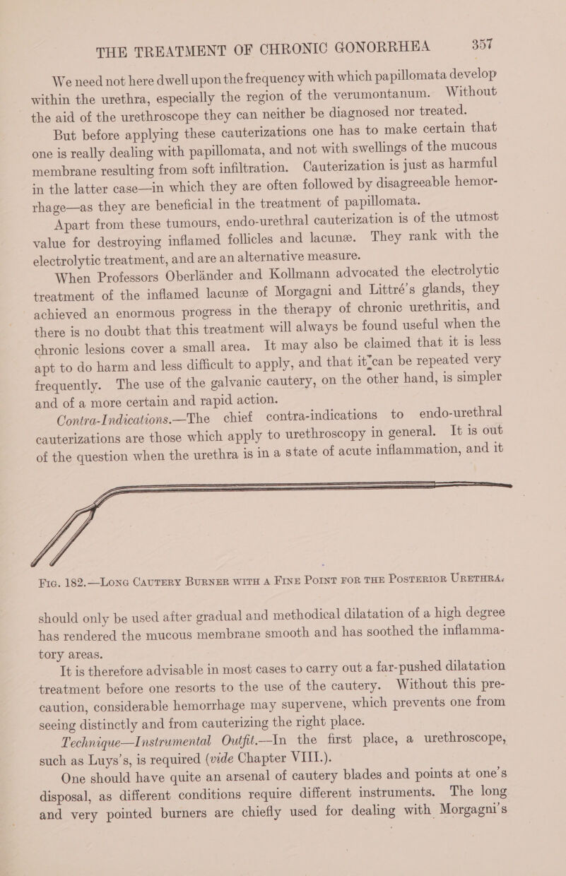 We need not here dwell upon the frequency with which papillomata develop within the urethra, especially the region of the verumontanum. Without the aid of the urethroscope they can neither be diagnosed nor treated. But before applying these cauterizations one has to make certain that one is really dealing with papillomata, and not with swellings of the mucous membrane resulting from soit infiltration. Cauterization is just as harmful in the latter case—in which they are often followed by disagreeable hemor- rhage—as they are beneficial in the treatment of papillomata. Apart from these tumours, endo-urethral cauterization is of the utmost value for destroying inflamed follicles and lacune. They rank with the electrolytic treatment, and are an alternative measure. When Professors Oberländer and Kollmann advocated the electrolytic treatment of the inflamed lacunæ of Morgagni and Littré’s glands, they achieved an enormous progress in the therapy of chronic urethritis, and there is no doubt that this treatment will always be found useful when the chronic lesions cover a small area. It may also be claimed that it 1s less apt to do harm and less difficult to apply, and that it'ean be repeated very frequently. The use of the galvanic cautery, on the other hand, is simpler and of a more certain and rapid action. Contra-Indications.—The chief contra-indications to endo-urethral cauterizations are those which apply to urethroscopy in general. It 1s out of the question when the urethra is in à state of acute inflammation, and it Fra. 182.—_Lone CAUTERY BURNER WITH A FINE POINT FOR THE PosTERIOR URETHRA. should only be used after gradual and methodical dilatation of a high degree has rendered the mucous membrane smooth and has soothed the inflamma- tory areas. It is therefore advisable in most cases to carry out a far-pushed dilatation treatment before one resorts to the use of the cautery. Without this pre- caution, considerable hemorrhage may supervene, which prevents one from seeing distinctly and from cauterizing the right place. Technique—Instrumental Outfit—In the first place, a urethroscope, such as Luys’s, is required (vide Chapter VIII.). One should have quite an arsenal of cautery blades and points at one’s disposal, as different conditions require different instruments. The long and very pointed burners are chiefly used for dealing with Morgagni’s
