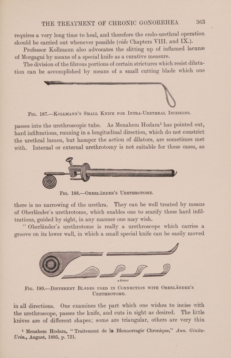 requires a very long time to heal, and therefore the endo-urethral operation should be carried out whenever possible (vide Chapters VIII. and IX.). Professor Kollmann also advocates the slitting up of inflamed lacunæ of Morgagni by means of a special knife as a curative measure. The division of the fibrous portions of certain strictures which resist dilata- tion can be accomplished by means of a small cutting blade which one Fic. 187.—KozLLmManx’s SMALL KNIFE FOR INTRA-URETHRAL INCISIONS. passes into the urethroscopic tube. As Menahem Hodara' has pointed out, hard infiltrations, running in a longitudinal direction, which do not constrict the urethral lumen, but hamper the action of dilators, are sometimes met with. Internal or external urethrotomy is not suitable for these cases, as Fra. 188.—OBERLANDER’S URETHROTOME. there is no narrowing of the urethra. They can be well treated by means of Oberländer’s urethrotome, which enables one to scarify these hard infil- trations, guided by sight, in any manner one may wish. ‘“ Oberlander’s urethrotome is really a urethroscope which carries a groove on its lower wall, in which a small special knife can be easily moved Fig. 189.—DIFFERENT BLADES USED IN CONNECTION WITH OBERLANDER’S URETHROTOME. in all directions. One examines the part which one wishes to incise with the urethroscope, passes the knife, and cuts in sight as desired. The little knives are of different shapes; some are triangular, others are very thin 1 Menahem Hodara, ‘‘ Traitement de la Blennorragie Chronique,” Ann. Génito- Urin., August, 1895, p. 721. |
