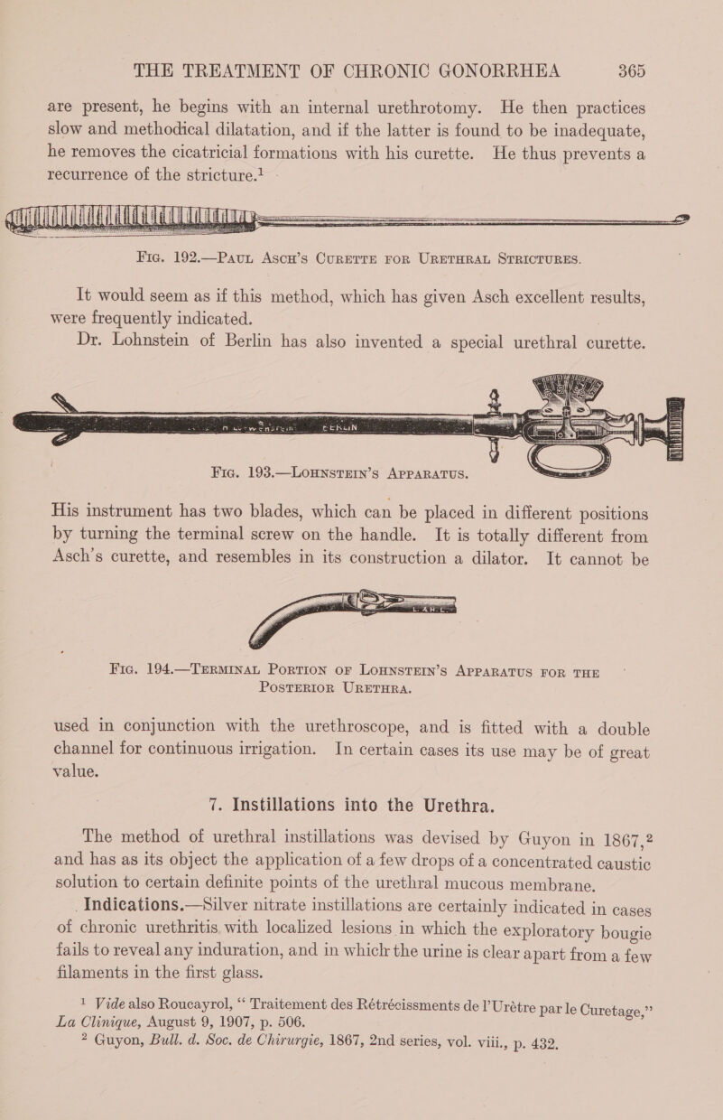 Fi. 192.—Pauz Ascu’s CURETTE FOR URETHRAL STRICTURES. It would seem as if this method, which has given Asch excellent results, were frequently indicated. : Dr. Lohnstein of Berlin has also invented a special urethral curette. Fic. 193.—LOHNSTEIN’S APPARATUS. His instrument has two blades, which can be placed in different positions by turning the terminal screw on the handle. It is totally different from Asch’s curette, and resembles in its construction a dilator. It cannot be Fic. 194.—TERMINAL PORTION oF LOHNSTEIN’S APPARATUS FOR THE POSTERIOR URETHRA. used in conjunction with the urethroscope, and is fitted with a double channel for continuous irrigation. In certain cases its use may be of great value. 7. Instillations into the Urethra. The method of urethral instillations was devised by Guyon in 1867 a and has as its object the application of a few drops of a concentrated caustic solution to certain definite points of the urethral mucous membrane. _Indieations.—silver nitrate instillations are certainly indicated in cases of chronic urethritis with localized lesions in which the exploratory bougie fails to reveal any induration, and in whiclr the urine is clear apart from a few filaments in the first glass. 1 Vide also Roucayrol, “ Traitement des Rétrécissments de l’ Urétre La Clinique, August 9, 1907, p. 506. ? Guyon, Bull. d. Soc. de Chirurgie, 1867, 2nd series, vol. viii., D. 492. par le Curetage,”’