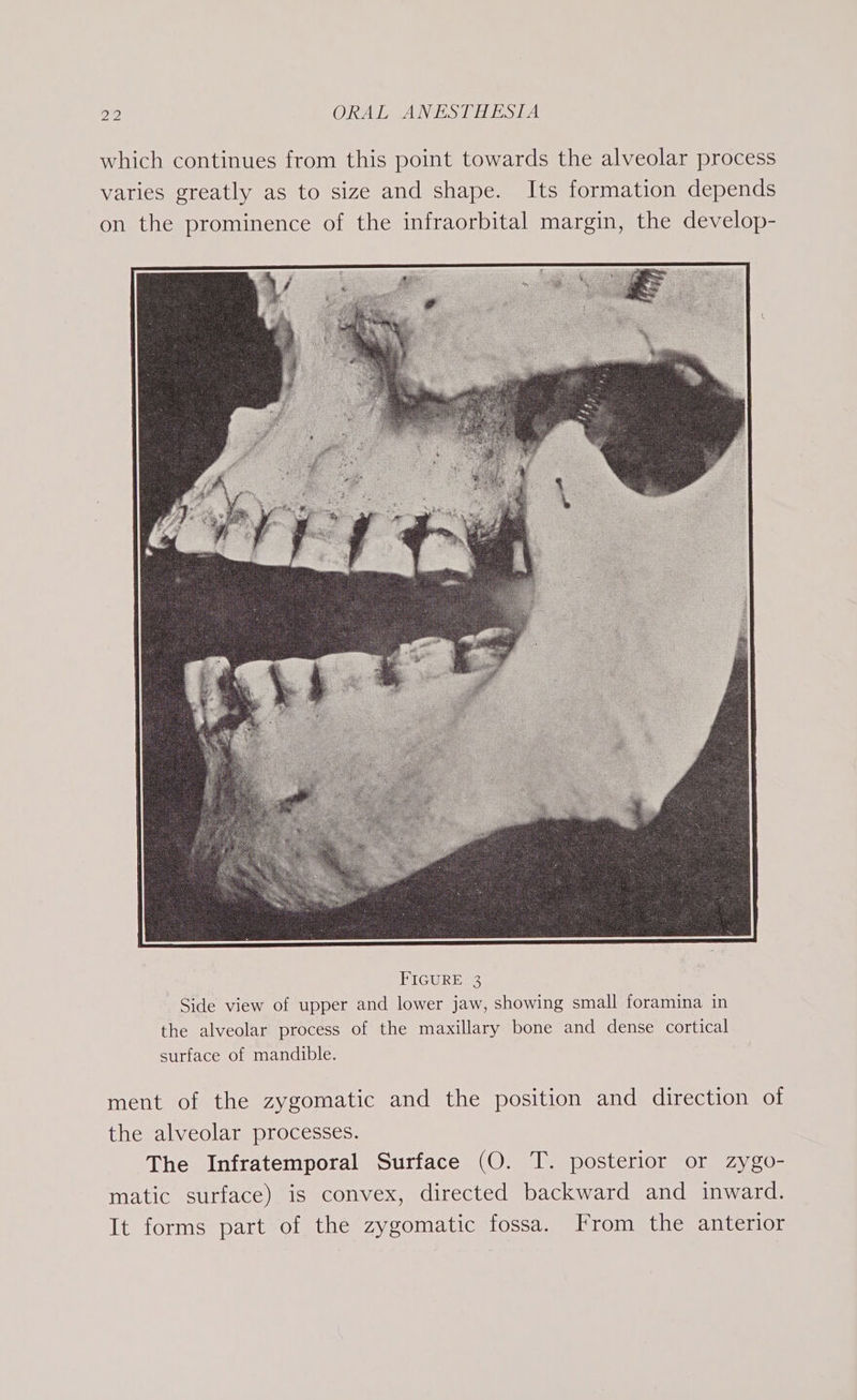 which continues from this point towards the alveolar process varies greatly as to size and shape. Its formation depends on the prominence of the infraorbital margin, the develop- ment of the zygomatic and the position and direction of the alveolar processes. The Infratemporal Surface (O. T. posterior or zygo- matic surface) is convex, directed backward and inward. It forms part of the zygomatic fossa. From the anterior