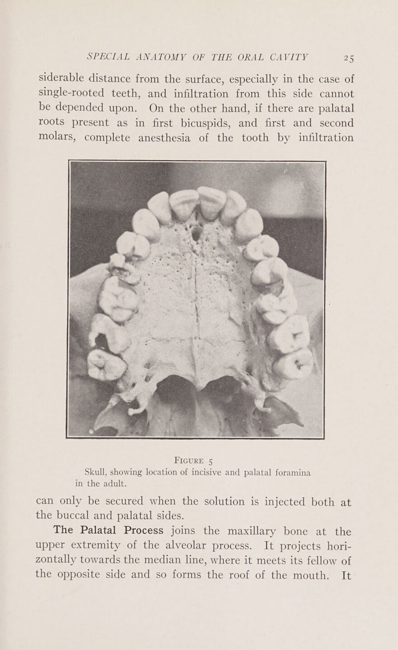 siderable distance from the surface, especially in the case of single-rooted teeth, and infiltration from this side cannot be depended upon. On the other hand, if there are palatal roots present as in first bicuspids, and first and second molars, complete anesthesia of the tooth by infiltration can only be secured when the solution is injected both at the buccal and palatal sides. The Palatal Process joins the maxillary bone at the upper extremity of the alveolar process. It projects hori- zontally towards the median line, where it meets its fellow of the opposite side and so forms the roof of the mouth. It