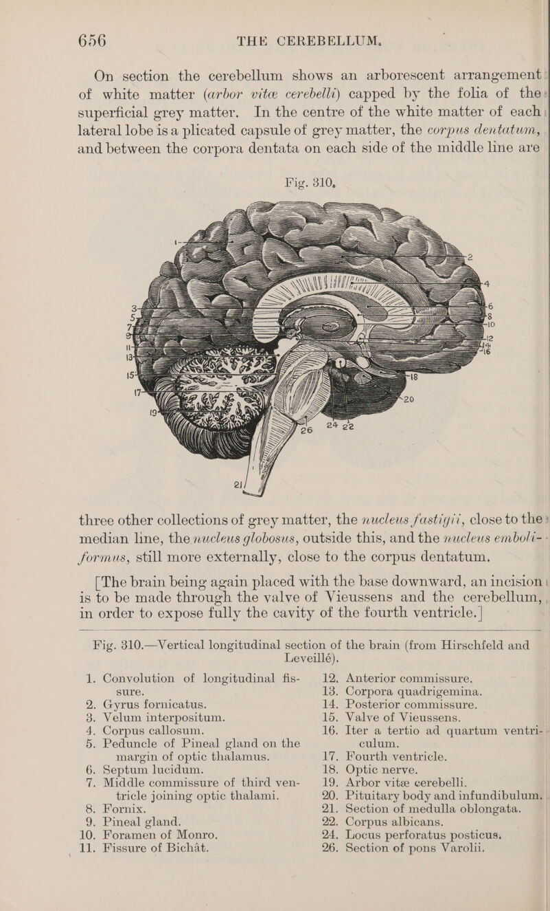 On section the cerebellum shows an arborescent arrangement of white matter (arbor vite cerebelli) capped by the folia of the: superficial grey matter. In the centre of the white matter of each: lateral lobe isa plicated capsule of grey matter, the corpus dentatum, and between the corpora dentata on each side of the middle line are three other collections of grey matter, the nucleus fastiyi’, close to the » median line, the nwcleus globosus, outside this, and the nucleus emboli- - formus, still more externally, close to the corpus dentatum. [The brain being again placed with the base downward, an incision | is to be made through the valve of Vieussens and the cerebellum, , in order to expose fully the cavity of the fourth ventricle. | Fig. 310.—Vertical longitudinal section of the brain (from Hirschfeld and Leveillé). 1. Convolution of longitudinal fis- 12. Anterior commissure. sure. 13. Corpora quadrigemina. 2. Gyrus fornicatus. 14. Posterior commissure. 3. Velum interpositum. 15. Valve of Vieussens. 4. Corpus callosum. 16. Iter a tertio ad quartum ventri-- 5. Peduncle of Pineal gland on the culum. margin of optic thalamus. 17. Fourth ventricle. 6. Septum lucidum. 18. Optic nerve. 7. Middle commissure of third ven- 19. Arbor vite cerebelh. tricle joining optic thalami. 20. Pituitary body and infundibulum, 8. Fornix. 21. Section of medulla oblongata. 9. Pineal gland. 22. Corpus albicans. 10. Foramen of Monro. 24. Locus perforatus posticus, 11. Fissure of Bichat. 26. Section of pons Varolii.