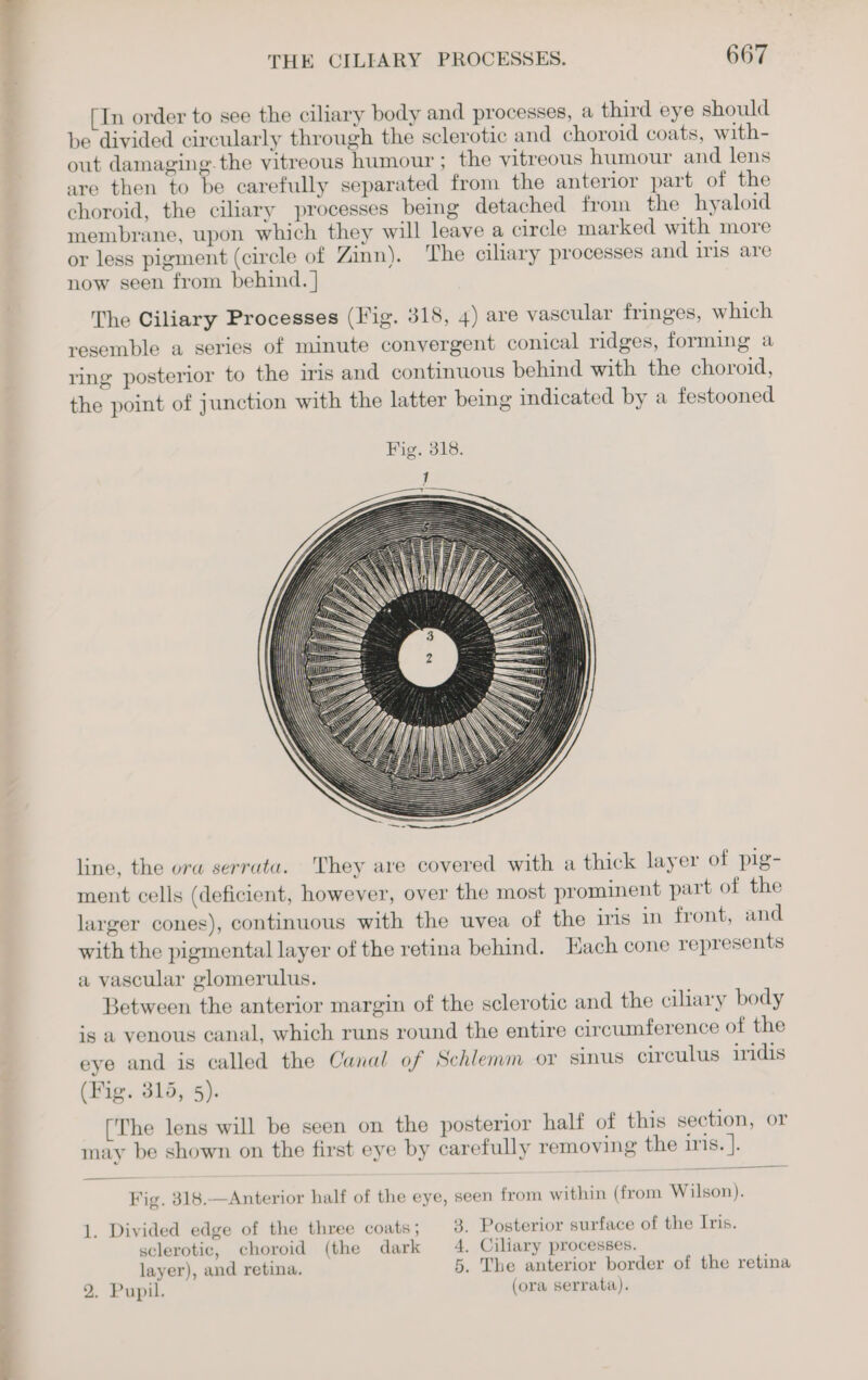 wll THE CILEARY PROCESSES. 667 [In order to see the ciliary body and processes, a third eye should be divided circularly through the sclerotic and choroid coats, with- out damaging.the vitreous humour ; the vitreous humour and lens are then to be carefully separated from the anterior part of the choroid, the ciliary processes being detached froin the hyaloid membrane, upon which they will leave a circle marked with more or less pigment (circle of Zinn). The ciliary processes and iris are now seen from behind. } The Ciliary Processes (Fig. 318, 4) are vascular fringes, which resemble a series of minute convergent conical ridges, forming a ring posterior to the iris and continuous behind with the choroid, the point of junction with the latter being indicated by a festooned line, the ora serrata. They are covered with a thick layer of pig- ment cells (deficient, however, over the most prominent part of the larger cones), continuous with the uvea of the iris in front, and with the pigmental layer of the retina behind. Hach cone represents a vascular glomerulus. Between the anterior margin of the sclerotic and the ciliary body is a venous canal, which runs round the entire circumference of the eye and is called the Canal of Schlemm or sinus circulus iridis (Fig. 315, 5). [The lens will be seen on the posterior half of this section, or may be shown on the first eye by carefully removing the iris. ]. Fig. 318.—Anterior half of the eye, seen from within (from Wilson). 1. Divided edge of the three coats ; 3. Posterior surface of the Iris. sclerotic, choroid (the dark 4. Ciliary processes. layer), and retina. 5, The anterior border of the retina 2. Pupil. (ora serrata).
