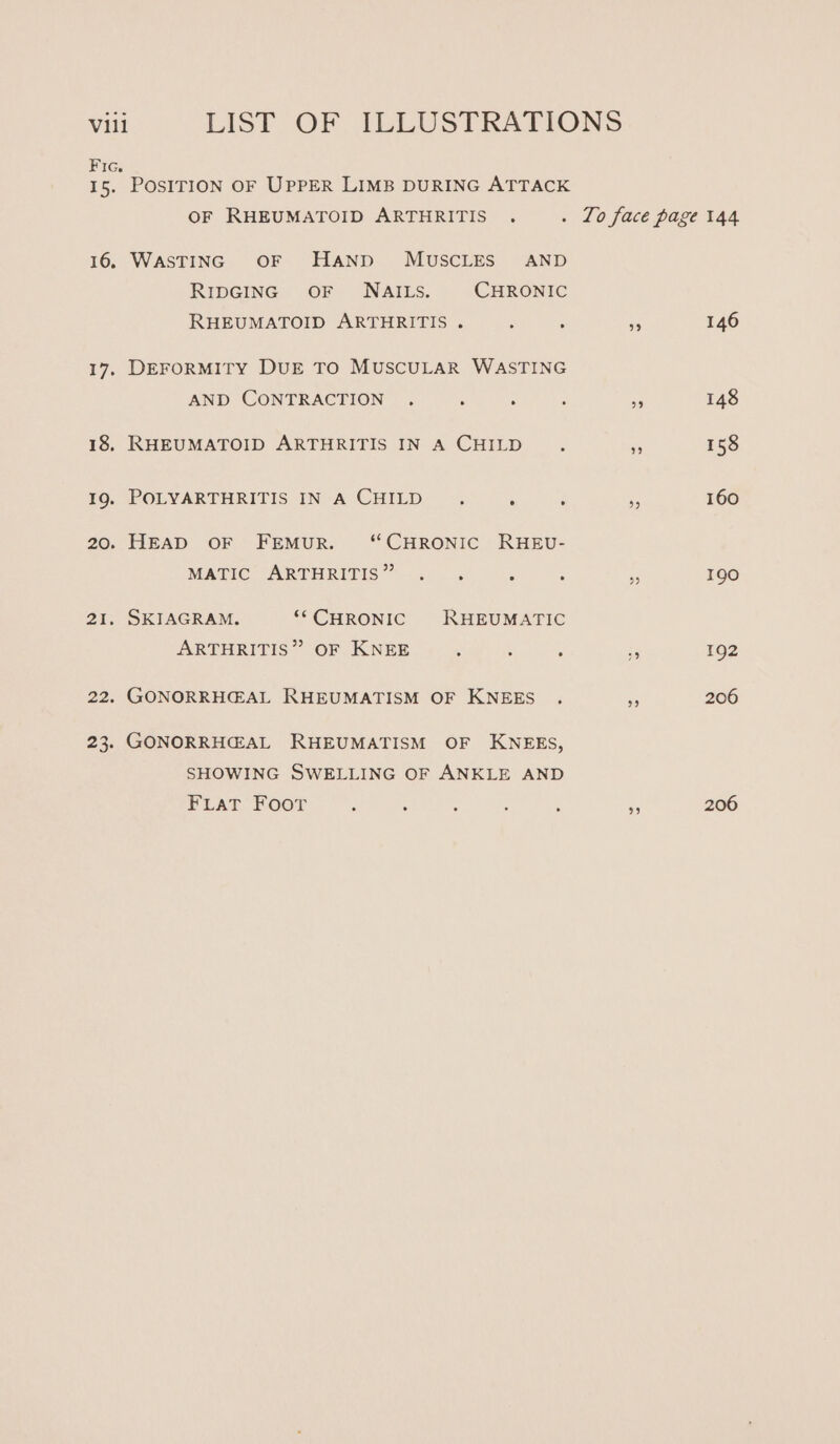 Fic. 15. 16. 17. 18, 19. 20. 21. 22. 233 POSITION OF UPPER LIMB DURING ATTACK OF RHEUMATOID ARTHRITIS . : WASTING OF Hanpd MUSCLES AND RIDGING OF NAILS. CHRONIC RHEUMATOID ARTHRITIS . : 5 DEFORMITY DUE TO MUSCULAR WASTING AND CONTRACTION . i : RHEUMATOID ARTHRITIS IN A CHILD POLYARTHRITIS IN A CHILD . ° ’ HEAD OF FEMUR. “CHRONIC RHEU- MATIC ARTHRITIS” . . i SKIAGRAM. ** CHRONIC RHEUMATIC ARTHRITIS” OF KNEE : : : GONORRHCAL RHEUMATISM OF KNEES . GONORRH@AL RHEUMATISM OF KNEES, SHOWING SWELLING OF ANKLE AND FLAT Foor 146 148 158 160 190 192 206 206