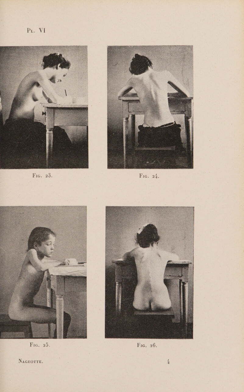 FiG. 29: Fic. 24. NAGEOTTE.