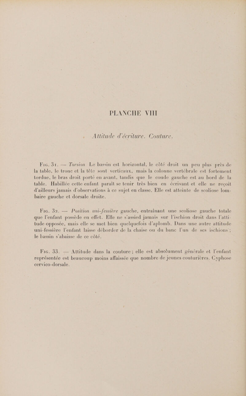 Attitude d'écriture. Couture. Fire. 31. — Torsion. Le bassin est horizontal, le côté droit un peu plus près de la table, le tronc et la tête sont verticaux, mais la colonne vertébrale est fortement tordue, le bras droit porté en avant, tandis que le coude gauche est au bord de la table. Habillée cette enfant parait se tenir très bien en écrivant et elle ne reçoit d’ailleurs jamais d'observations à ce sujet en classe. Elle est atteinte de scoliose lom- baire gauche et dorsale droite. Fic. 32. — Position uni-fessière gauche, entraïnant une scoliose gauche totale que l’enfant possède en effet. Elle ne s’assied jamais sur l’ischion droit dans l’atti- tude opposée, mais elle se met bien quelquefois d’aplomb. Dans une autre attitude uni-fessière l’enfant laisse déborder de la chaise ou du banc l’un de ses ischions ; le bassin s’abaisse de ce côté. F1G. 33. — Attitude dans la couture ; elle est absolument générale et l'enfant représentée est beaucoup moins affaissée que nombre de Jeunes couturières. Cyphose cervico-dorsale.