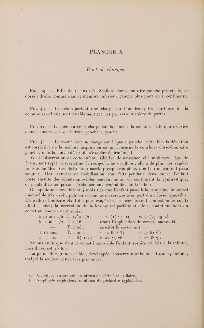 Port de charges. Fic. 39. — Fille de 12 ans 1/2. Scoliose dorso-lombaire gauche principale, et dorsale droite commençante ; membre inférieur gauche plus court de 1 centimètre. F1G. 40. — La même portant une charge du bras droit; les courbures de la colonne vertébrale sont notablement accrues par cette manière de porter. Fi. 41. — La même avec sa charge sur la hanche; la colonne est toujours déviée dans le mème sens et le tronc penché à gauche. Fra. 42. — La mème avec sa charge sur l'épaule gauche, cette fois la déviation est corrective de la scoliose acquise en ce qui concerne la courbure dorso-lombaire gauche, mais la convexité droite s’exagère énormément. Voici l'observation de cette enfant. Chétive de naissance, elle subit vers l’âge de 5 ans, sans répit, la scarlatine, la rougeole, les oreillons ; elle a de plus des végéta- tions adénoïdes avec obstruction nasale presque complète, que l’on ne consent pas à soigner. Des exercices de mobilisation sont faits pendant deux mois; l'enfant porte ensuite des corsets amovibles pendant un an en continuant la gymnastique, et pendant ce temps son développement général devient très bon. On applique alors durant 4 mois 1/2 que l'enfant passe à la campagne un corset inamovible très droit, puis on revient aux exercices avec port d’un corset amovible. L’ensellure lombaire étant des plus exagérées, les corsets sont confectionnés sur la fillette assise ; la correction de la lordose est parfaite et elle se maintient hors du corset au bout de deux mois: à 12 aûs 4/9: TN 40 2/25 nas (1) 0ic60S Er an) oo aÿrorans 1/2.°1:51,40; avant l’application du corset inamovible #e. Derics aussitôt le corset mis à 14 ans. TL 1405 r. ax 65-68 ; r, æy 6:-63 à 19 ans. Fr PTE Pr. ax 9h70 r. æy 68-70. Notons enfin que dans le corset inamovible l'enfant respire 18 fois à la minute, . hors du corset 15 fois. La jeune fille grande et bien développée, conserve une bonne attitude générale, malgré la scoliose restée très prononcée. (1) Amplilude respiratoire au niveau du périmètre axillaire. (2) Amplitude respiratoire au niveau du périmètre xyphoïdien.