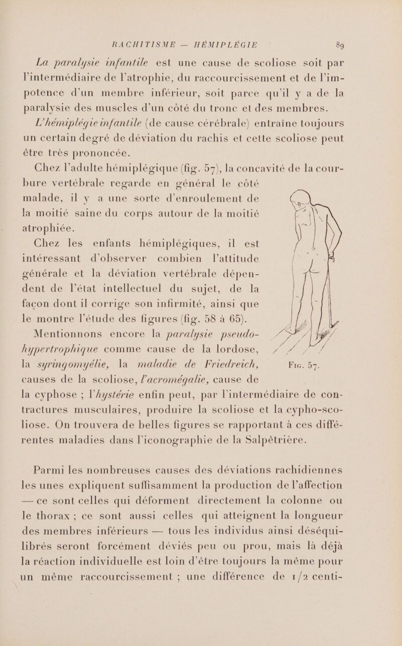 La paralysie infantile est une cause de scoliose soit par l'intermédiaire de l’atrophie, du raccoureissement et de l’im- potence d'un membre inférieur, soit parce qu'il y a de la paralysie des muscles d’un côté du tronc et des membres. L’hémipléqgie infantile (de cause cérébrale) entraîne toujours un certain degré de déviation du rachis et cette scoliose peut être très prononcée. Chez l'adulte hémiplégique (fig. 57), la concavité de la cour- bure vertébrale regarde en général le côté malade, il y a une sorte d’enroulement de la moitié saine du corps autour de la moitié atrophiée. Chez les enfants hémiplégiques, il est intéressant d'observer combien l'attitude générale et la déviation vertébrale dépen- dent de l’état intellectuel du sujet, de la facon dont il corrige son infirmité, ainsi que le montre l'étude des figures (fig. 58 à 65). Mentionnons encore la paralysie pseudo- hypertrophique comme cause de la lordose, 7° # 7. la syringomyélie, la maladie de Friedreich, Fic. 57. causes de la scoliose, l’acromégalie, cause de la cyphose ; l’hystérie enfin peut, par l'intermédiaire de cOn- tractures musculaires, produire la scoliose et la cypho-sco- liose. On trouvera de belles figures se rapportant à ces diffé- rentes maladies dans l'iconographie de la Salpêtrière. Parmi les nombreuses causes des déviations rachidiennes les unes expliquent suffisamment la production de l’affection — ce sont celles qui déforment directement la colonne ou le thorax ; ce sont aussi celles qui atteignent la longueur des membres inférieurs — tous les individus ainsi déséqui- librés seront forcément déviés peu ou prou, mais là déjà la réaction individuelle est loin d’être toujours la même pour un même raccourcissement ; une différence de 1/2 centi-