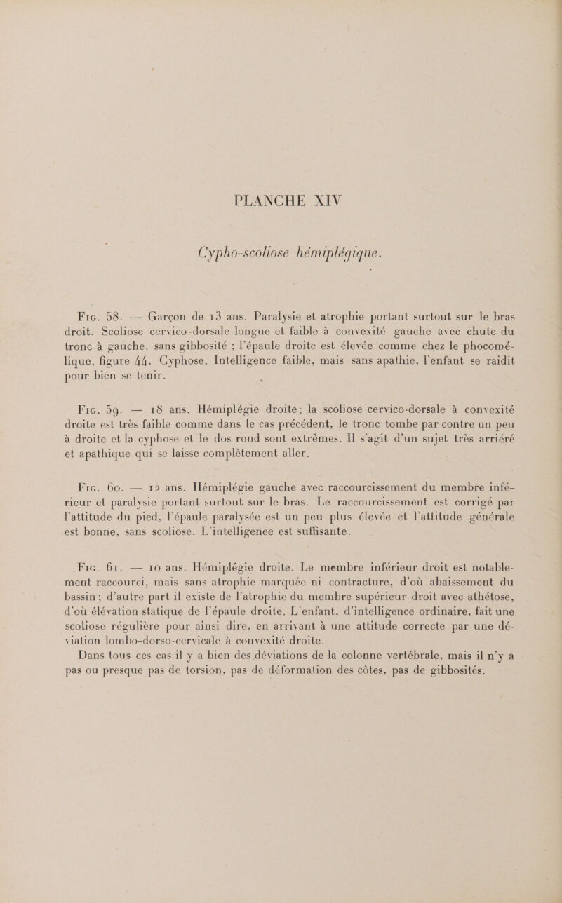Cypho-scoliose hémiplégique. Fr. 58. — Garçon de 13 ans. Paralysie et atrophie portant surtout sur le bras droit. Scoliose cervico-dorsale longue et faible à convexité gauche avec chute du tronc à gauche, sans gibbosité ; l'épaule droite est élevée comme chez le phocomé- lique, figure 44. Cyphose. Intelligence faible, mais sans apathie, l'enfant se raidit pour bien se tenir. L Fic. 59. — 18 ans. Hémiplégie droite; la scoliose cervico-dorsale à convexité droite est très faible comme dans le cas précédent, le tronc tombe par contre un peu à droite et la cyphose et le dos rond sont extrèmes. Il s'agit d’un sujet très arriéré et apathique qui se laisse complètement aller. Fic. 60. — 12 ans. Hémiplégie gauche avec raccourcissement du membre infé- rieur et paralysie portant surtout sur le bras. Le raccourcissement est corrigé par l'attitude du pied, l’épaule paralysée est un peu plus élevée et l'attitude générale est bonne, sans scoliose. L’intelligenee est suflisante. Fic. 61. — 10 ans. Hémiplégie droite. Le membre inférieur droit est notable- ment raccourci, mais sans atrophie marquée ni contracture, d’où abaissement du bassin ; d'autre part il existe de l’atrophie du membre supérieur droit avec athétose, d’où élévation statique de l’épaule droite. L'enfant, d'intelligence ordinaire, fait une scoliose régulière pour ainsi dire, en arrivant à une attitude correcte par une dé- viation lombo-dorso-cervicale à convexité droite. Dans tous ces cas il y a bien des déviations de la colonne vertébrale, mais il n’y a pas ou presque pas de torsion, pas de déformalion des côtes, pas de gibbosités.