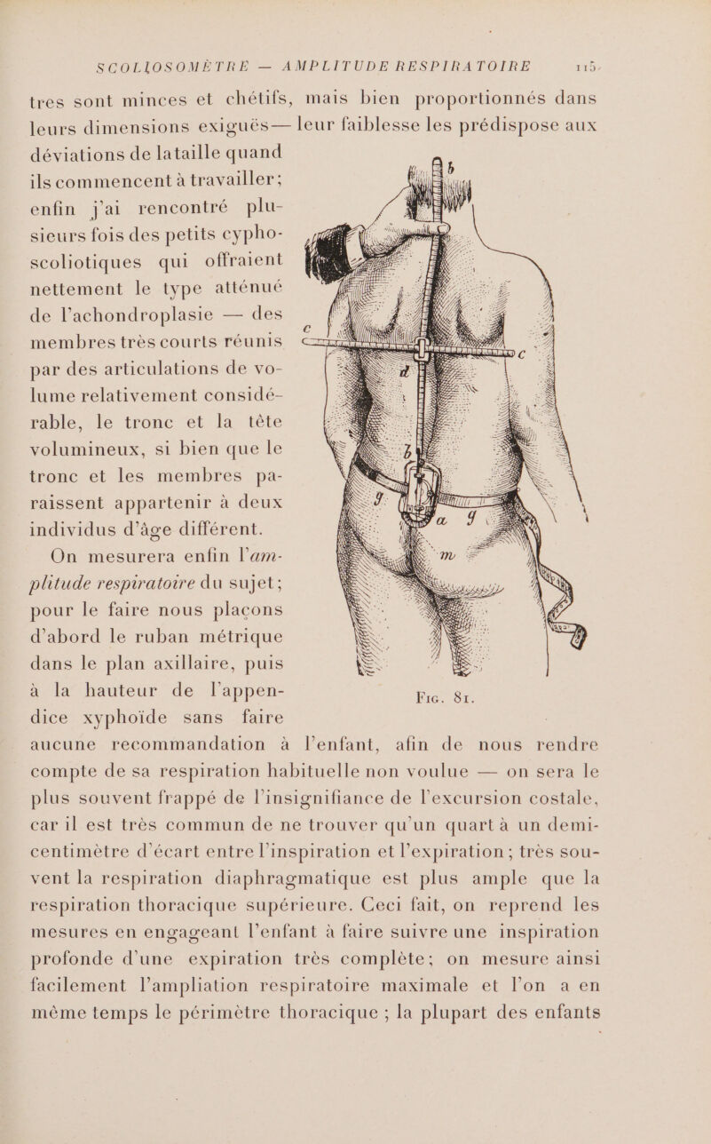 tres sont minces et chétifs, mais bien proportionnés dans leurs dimensions exiguës— leur faiblesse les prédispose aux déviations de lataille quand ils commencent à travailler; enfin j'ai rencontré plu- sieurs fois des petits cypho- scoliotiques qui offraient nettement le type atténué de l’achondroplasie — des membres très courts réunis par des articulations de vo- lume relativement considé- rable, le tronc et la tête volumineux, si bien que le tronc et les membres pa- raissent appartenir à deux individus d’âge différent. On mesurera enfin l’am- plitude respiratoire du sujet; pour le faire nous placons d’abord le ruban métrique dans le plan axillaire, puis à la hauteur de l'appen- dice xyphoïde sans faire aucune recommandation à Vlenfant, afin de nous rendre compte de sa respiration habituelle non voulue — on sera le plus souvent frappé de l’insignifiance de l’excursion costale, car 1l est très commun de ne trouver qu'un quart à un demi- centimètre d'écart entre l'inspiration et l'expiration; très sou- vent la respiration diaphragmatique est plus ample que la respiration thoracique supérieure. Ceci fait, on reprend les mesures en engageant l'enfant à faire suivre une inspiration profonde d'une expiration très complète; on mesure ainsi facilement l’ampliation respiratoire maximale et l’on a en mème temps le périmètre thoracique ; la plupart des enfants