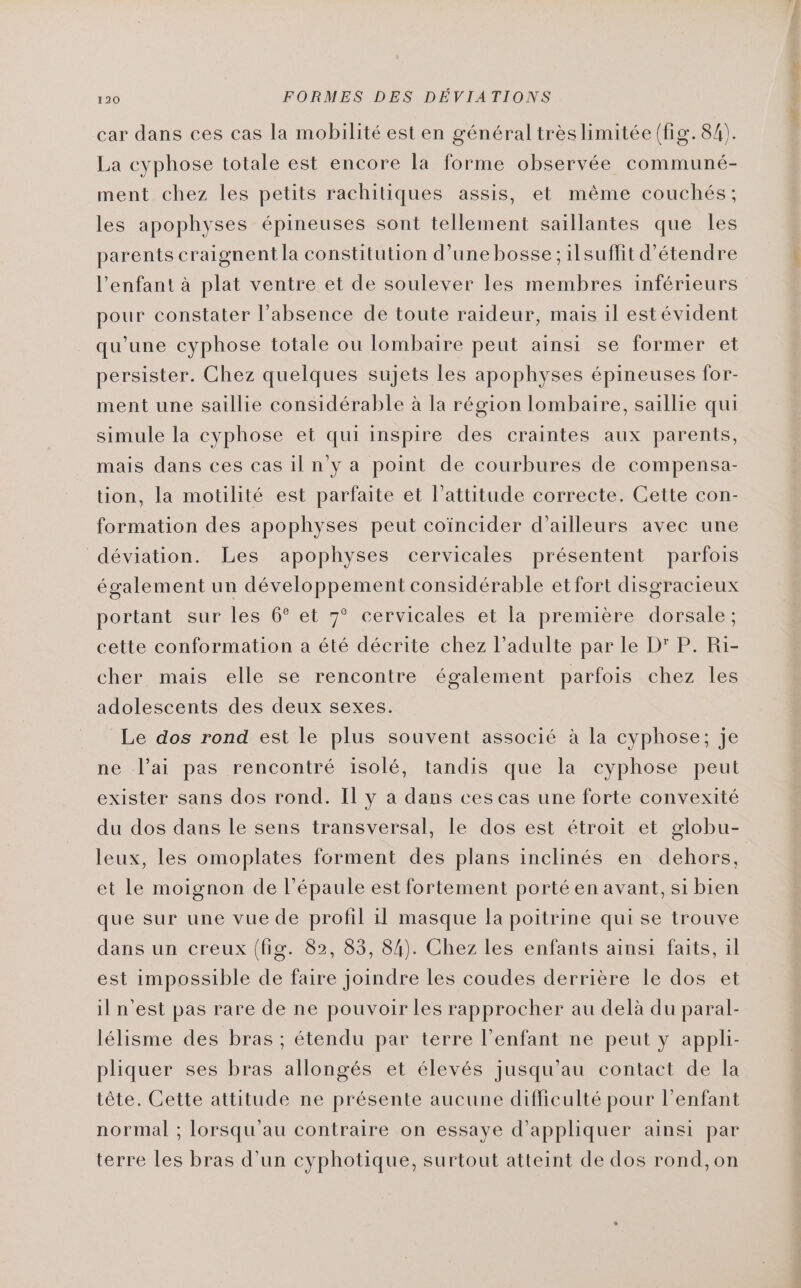 car dans ces cas la mobilité est en général très limitée (fig. 84). La cyphose totale est encore la forme observée communé- ment chez les petits rachitiques assis, et même couchés; les apophyses épineuses sont tellement saillantes que Îles parents craignent la constitution d’une bosse ; ilsuflit d'étendre l’enfant à plat ventre et de soulever les membres inférieurs pour constater l'absence de toute raideur, mais il estévident qu'une cyphose totale ou lombaire peut ainsi se former et persister. Chez quelques sujets les apophyses épineuses for- ment une saillie considérable à la région lombaire, saillie qui simule la cyphose et qui inspire des craintes aux parents, mais dans ces cas il n'y a point de courbures de compensa- tion, la motilité est parfaite et l'attitude correcte. Cette con- formation des apophyses peut coïncider d’ailleurs avec une déviation. Les apophyses cervicales présentent parfois également un développement considérable et fort disgracieux portant sur les 6° et 7° cervicales et la première dorsale; cette conformation a été décrite chez l'adulte par le D’ P. Ri- cher mais elle se rencontre également parfois chez les adolescents des deux sexes. Le dos rond est le plus souvent associé à la cyphose; je ne l'ai pas rencontré isolé, tandis que la cyphose peut exister sans dos rond. Il y a dans ces cas une forte convexité du dos dans le sens transversal, le dos est étroit et globu- leux, les omoplates forment des plans inclinés en dehors, et le moignon de l'épaule est fortement porté en avant, si bien dans un creux (fig. 82, 83, 84). Chez les enfants ainsi faits, il est impossible de faire joindre les coudes derrière le dos et il n’est pas rare de ne pouvoir les rapprocher au delà du paral- lélisme des bras ; étendu par terre l'enfant ne peut y appli- pliquer ses bras allongés et élevés jusqu’au contact de la tête. Cette attitude ne présente aucune difficulté pour l'enfant normal ; lorsqu'au contraire on essaye d'appliquer ainsi par terre les bras d’un cyphotique, surtout atteint de dos rond,on PS