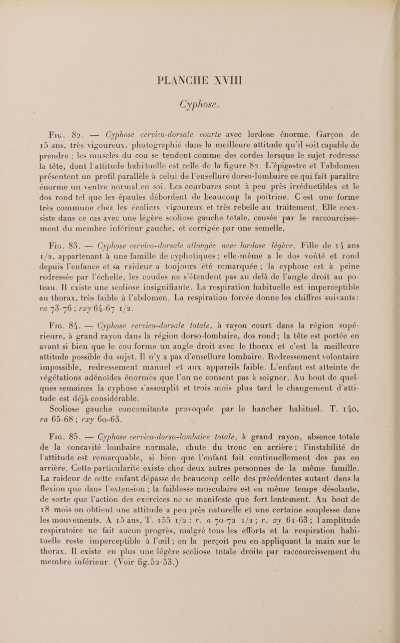 Cyphose. Fic. 82. — Cyphose cervico-dorsale courle avec lordose énorme. Garçon de 15 ans, très vigoureux, photographié dans la meilleure attitude qu'il soit capable de prendre ; les muscles du cou se tendent comme des cordes lorsque le sujet redresse la tête, dont l'attitude habituelle est celle de la figure 82. L’épigastre et l'abdomen présentent un profil parallèle à celui de l’ensellure dorso-lombaire ce qui fait paraitre énorme un ventre normal en soi. Les courbures sont à peu près irréductibles et le dos rond tel que les épaules débordent de beaucoup la poitrine. C’est une forme très commune chez les écoliers vigoureux et très rebelle au traitement. Elle coex- siste dans ce cas avec une légère scoliose gauche totale, causée par le raccourcisse- ment du membre inférieur gauche, et corrigée par une semelle, Fic. 83. — Cyphose cervico-dorsale allongée avec lordose légère. Fille de 14 ans 1/2, appartenant à une famille de cyphotiques ; elle-même a le dos voüté et rond depuis l'enfance et sa raideur a toujours été remarquée ; la cyphose est à peine redressée par l'échelle, les coudes ne s'étendent pas au delà de l'angle droit au po- teau. [l existe une scoliose insignifiante. La respiration habituelle est imperceptible au thorax, très faible à l'abdomen. La respiration forcée donne les chiffres suivants: ra 73-70 ; rxy 64-67 1/2. x Fic. 84. — Cyphose cervico-dorsale totale, à rayon court dans la région supé- rieure, à grand rayon dans la région dorso-lombaire, dos rond; la tête est portée en avant si bien que le cou forme un angle droit avec le thorax et c’est la meilleure attitude possible du sujet. Il n’y a pas d'ensellure lombaire. Redressement volontaire impossible, redressement manuel et aux appareils faible. L'enfant est atteinte de végétations adénoïdes énornxes que l’on ne consent pas à soigner. Au bout de quel- ques semaines la cyphose s'assouplit et trois mois plus tard le changement d’atti- tude est déjà considérable. Scoliose gauche concomitante provoquée par le hancher habituel. T. 140, ra 65-68 ; rxy 60-63. Fic. 85. — Cyphose cervico-dorso-lombaire totale, à grand rayon, absence totale de la concavité lombaire normale, chute du tronc en arrière; l'instabilité de l'attitude est remarquable, si bien que l’enfant fait continuellement des pas en arrière. Cette particularité existe chez deux autres personnes de la même famille. La raideur de cette enfant dépasse de beaucoup celle des précédentes autant dans la flexion que dans l'extension ; la faiblesse musculaire est en même temps désolante, de sorte que l’action des exercices ne se manifeste que fort lentement. Au bout de 18 mois on obtient une attitude a peu près naturelle et une certaine souplesse dans les mouvements. À 15 ans, T. 155 1/2: r. a 70-52 1/2; r. æy 61-63 ; l'amplitude respiratoire ne fait aucun progrès, malgré tous les efforts ‘et la respiration habi- tuelle reste imperceptible à l'œil; on la perçoit peu en appliquant la main sur le thorax. Il existe en plus une légère scoliose totale droite par raccourcissement du membre inférieur. (Voir fig.52-53.)