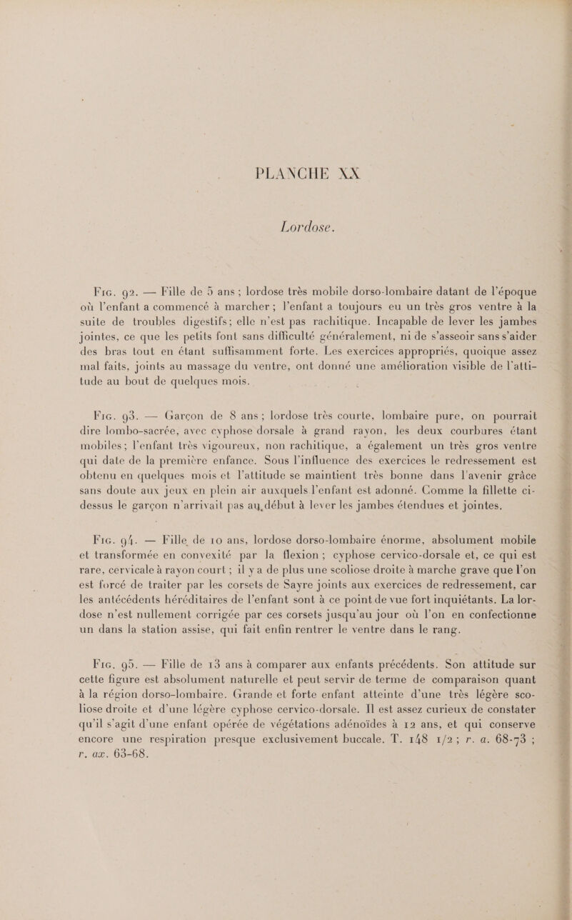 Lordose. Fr. 92. — Fille de 5 ans ; lordose très mobile dorso-lombaire datant de l’époque où l'enfant a commencé à marcher; l’enfant a toujours eu un très gros ventre à la suite de troubles digestifs; elle n’est pas rachitique. Incapable de lever les jambes jointes, ce que les petits font sans difficulté généralement, ni de s’asseoir sans s’aider des bras tout en étant suffisamment forte. Les exercices appropriés, quoique assez mal faits, joints au massage du ventre, ont donné une amélioration visible de l'atti- tude au bout de quelques mois. FrG. 93. — (Garçon de 8 ans; lordose très courte, lombaire pure, on pourrait dire lombo-sacrée, avec cvphose dorsale à grand rayon, les deux courbures étant mobiles ; l’enfant très vigoureux, non rachitique, a également un très gros ventre qui date de la première enfance. Sous l'influence des exercices le redressement est obtenu en quelques mois et l’attitude se maintient très bonne dans l'avenir grâce sans doute aux jeux en plein air auxquels l'enfant est adonné. Comme la fillette ci- dessus le garçon n’arrivait pas au, début à lever les jambes étendues et jointes. Fic. 94. — Fille de 10 ans, lordose dorso-lombaire énorme, absolument mobile et transformée en convexité par la flexion ; cyphose cervico-dorsale et, ce qui est rare, cervicale à rayon court ; il ya de plus une scoliose droite à marche grave que l’on est forcé de traiter par les corsets de Sayre joints aux exercices de redressement, car les antécédents héréditaires de l’enfant sont à ce point de vue fort inquiétants. La lor- dose n’est nullement corrigée par ces corsets jusqu’au jour où l’on en confectionne un dans la station assise, qui fait enfin rentrer le ventre dans le rang. F1G. 95. — Fille de 13 ans à comparer aux enfants précédents. Son attitude sur cette figure est absolument naturelle et peut servir de terme de comparaison quant à la région dorso-lombaire. Grande et forte enfant atteinte d’une très légère sco- liose droite et d’une légère cyphose cervico-dorsale. Il est assez curieux de constater qu'il s’agit d’une enfant opérée de végétations adénoïdes à 12 ans, et qui conserve encore une respiration presque exclusivement buccale. T. 148 1/2; r. a. 68-73 ; r. ax. 63-68. v