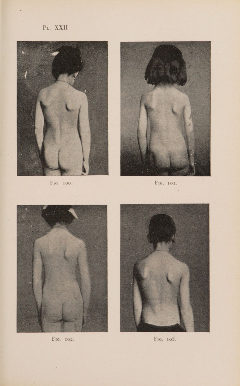 IOI TZ « IG F O0 I Fi. he) Fic.