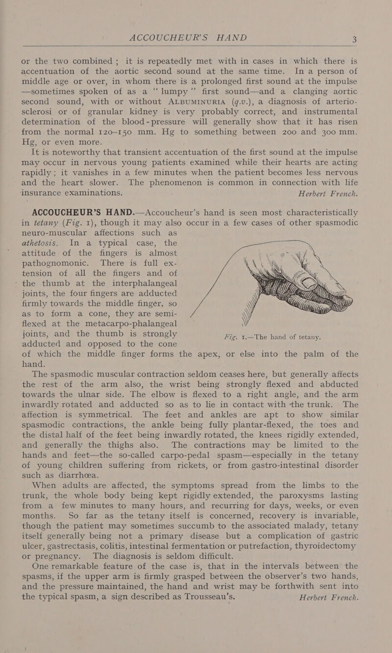 ACCOUCHEUR’S HAND B or the two combined ; it is repeatedly met with in cases in which there is accentuation of the aortic second sound at the same time. In a person of middle age or over, in whom there is a prolonged first sound at the impulse —sometimes spoken of as a “lumpy ”’ first sound—and a clanging aortic second sound, with or without ALBUMINURIA (q.v.), a diagnosis of arterio- sclerosi or of granular kidney is very probably correct, and instrumental determination of the blood-pressure will generally show that it has risen from the normal 120-150 mm. Hg to something between 200 and 300 mm. Hg, or even more. It is noteworthy that transient accentuation of the first sound at the impulse may occur in nervous young patients examined while their hearts are acting rapidly ; it vanishes in a few minutes when the patient becomes less nervous and the heart slower. The phenomenon is common in connection with life insurance eXaminations. Herbert French. ACCOUCHEUR’S HAND.—Accoucheur’s hand is seen most characteristically in tetany (Fig. 1), though it may also occur in a few cases of other spasmodic neuro-muscular affections such as athetosis. In a typical case, the attitude of the fingers is almost pathognomonic. There is full ex- tension of all the fingers and of - the thumb at the interphalangeal joints, the four fingers are adducted firmly towards the middle finger, so as to form a cone, they are semi- flexed at the metacarpo-phalangeal joints, and the thumb is strongly fig. 1.—The hand of tetany. adducted and opposed to the cone ; of which the middle finger forms the apex, or else into the palm of the hand. The spasmodic muscular contraction seldom ceases here, but generally affects the rest of the arm also, the wrist being strongly flexed and abducted towards the ulnar side. The elbow is flexed to a right angle, and the arm inwardly rotated and adducted so as to lie in contact with the trunk. The affection is symmetrical. The feet and ankles are apt to show similar spasmodic contractions, the ankle being fully plantar-flexed, the toes and the distal half of the feet being inwardly rotated, the knees rigidly extended, and generally the thighs also. The contractions may be limited to the hands and feet—the so-called carpo-pedal spasm—especially in the tetany of young children suffering from rickets, or from gastro-intestinal disorder such as diarrhea. When adults are. affected, the symptoms spread from the limbs to the trunk, the whole body being kept rigidly extended, the paroxysms lasting from a few minutes to many hours, and recurring for days, weeks, or even months. So far as the tetany itself is concerned, recovery is invariable, though the patient may sometimes succumb to the associated malady, tetany itself generally being not a primary disease but a complication of gastric ulcer, gastrectasis, colitis, intestinal fermentation or putrefaction, thyroidectomy or pregnancy. The diagnosis is seldom difficult. One remarkable feature of the case is, that in the intervals between the spasms, if the upper arm is firmly grasped between the observer’s two hands, and the pressure maintained, the hand and wrist may be forthwith sent into the typical spasm, a sign described as Trousseau’s, Herbert French.