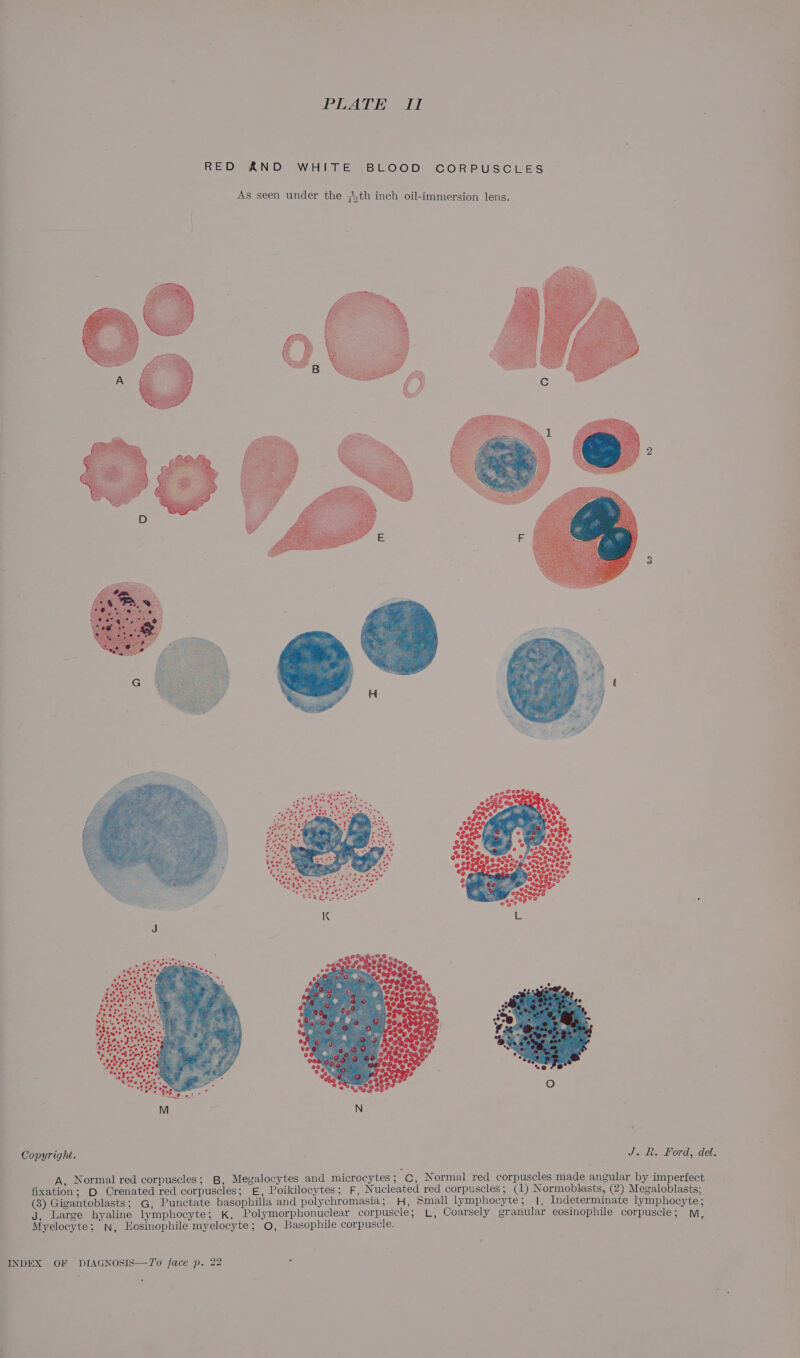 PLATE II RED AND WHITE BLOOD CORPUSCLES Copyright. J. R&amp;R. Ford, del. A, Normal red corpuscles; B, Megalocytes and microcytes ; ie, Normal red corpuscles made angular by imperfect fixation; D Crenated red corpuscles; E, Poikilocytes; F, Nucleated red corpuscles; (1) Normoblasts, (2) Megaloblasts; (8) Gigantoblasts; G, Punctate basophilla and polychromasia; H, Small lymphocyte; 1, Indeterminate lymphocyte; J, Large hyaline lymphocyte; K, Polymorphonuclear corpuscle; L, Coarsely granular eosinophile corpuscle; M, Myelocyte: N, Eosinophile myelocyte; ©, Basophile corpuscle.