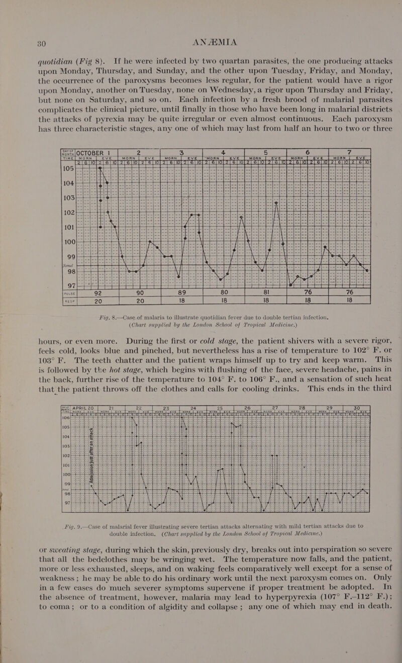quotidian (Fig 8). If he were infected by two quartan parasites, the one producing attacks upon Monday, Thursday, and Sunday, and the other upon Tuesday, Friday, and Monday, the occurrence of the paroxysms becomes less regular, for the patient would have a rigor upon Monday, another on Tuesday, none on Wednesday, a rigor upon Thursday and Friday, but none on Saturday, and so on. Each infection by a fresh brood of malarial parasites complicates the clinical picture, until finally in those who have been long in malarial districts the attacks of pyrexia may be quite irregular or even almost continuous. Each paroxysm has three characteristic stages, any one of which may last from half an hour to two or three Fig. 8.—Case of malaria to illustrate quotidian fever due to double tertian infection. (Chart supplied by the London School of Tropical Medicine.) hours, or even more. During the first or cold stage, the patient shivers with a severe rigor, feels cold, looks blue and pinched, but nevertheless has a rise of temperature to 102° F’. or 103° F. The teeth chatter and the patient wraps himself up to try and keep warm. This is followed by the hot stage, which begins with flushing of the face, severe headache, pains in the back, further rise of the temperature to 104° F. to 106° F., and a sensation of such heat that the patient throws off the clothes and calls for cooling drinks. This ends in the third A ‘emission justlafter'an attack) | or sweating stage, during which the skin, previously dry, breaks out into perspiration so severe that all the bedclothes may be wringing wet. The temperature now falls, and the patient, more or less exhausted, sleeps, and on waking feels comparatively well except for a sense of weakness ; he may be able to do his ordinary work until the next paroxysm comes on. Only in a few cases do much severer symptoms supervene if proper treatment be adopted. In the absence of treatment, however, malaria may lead to hyperpyrexia (107° F.-112° F.); to coma; or to a condition of algidity and collapse ; any one of which may end in death.