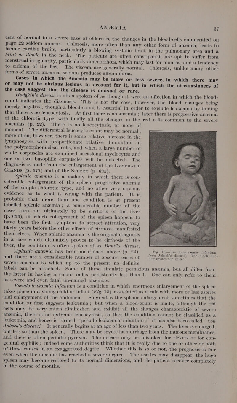 cent of normal in a severe case of chlorosis, the changes in the blood-cells enumerated on page 22 seldom appear. Chlorosis, more often than any other form of anzmia, leads to hemic cardiac bruits, particularly a blowing systolic bruit in the pulmonary area and a bruit de diable in the neck. The patients are often constipated, are apt to suffer from menstrual irregularity particularly amenorrhcea, which may last for months, and a tendency to codema of the feet. The viscera are generally normal. Chlorosis, unlike many other forms of severe anemia, seldom produces albuminuria. Cases in which the Anemia may be more or less severe, in which there may or may not be obvious lesions to account for it, but in which the circumstances of the case suggest that the disease is unusual or rare. | Hodgkin’s disease is often spoken of as though it were an affection in which the blood- count. indicates the diagnosis. This is not the case, however, the blood changes being merely negative, though a blood-count is essential in order to exclude leukemia by finding that there is no leucocytosis. At first there is no anemia ; later there is progressive anzemia of the chlorotic type, with finally all the changes in the red cells common to the severe anzemias (p. 22). There is no leucocytosis, or none of moment. The differential leucocyte count may be normal ; more often, however, there is some relative increase in the _lymphocytes with proportionate relative diminution in the polymorphonuclear cells, and when a large number of white corpuscles are examined occasional myelocytes and one or two basophile corpuscles will be detected. The diagnosis is made from the enlargement of the LymPHatic GLANDS (p. 377) and of the SPLEEN (p. 635). Splenic anemia is a malady in which there is con- siderable enlargement of the spleen, progressive ansemia of the simple chlorotic type, and no other very obvious evidence as to what is wrong with the patient. It is probable that more than one condition is at present labelled splenic anemia; a considerable number of the cases turn out ultimately to be cirrhosis of the liver (p. 633), in which enlargement of the spleen happens to have been the first symptom to attract attention, very likely years before the other effects of cirrhosis manifested themselves. When splenic anemia is the original diagnosis im a case which ultimately proves to be cirrhosis of the liver, the condition is often spoken of as Banti’s disease. Aplastic anemia has been mentioned above (p. 24), Fig. 13.—Pseudo-leukemia infantum : (von Jaksch’s disease). The black line and there are a considerable number of obscure cases of demarcates the spleen. severe anemia to which up to the present no definite labels can be attached. Some of these simulate pernicious anzemia, but all differ from the latter in having a colour index persistently less than 1. One can only refer to them as severe and even fatal un-named anzmias. Pseudo-leukemia infantum is a condition in which enormous enlargement of the spleen takes place in a young child or infant (Fig. 13), associated as a rule with more or less ascites and enlargement of the abdomen. So great is the splenic enlargement sometimes that the condition at first suggests leukeemia ; but when a blood-count is made, although the red cells may be very much diminished and exhibit all the changes characteristic of severe anemia, there is no extreme leucocytosis, so that the condition cannot be classified as a leukemia, and hence is termed ‘ pseudo-leukeemia infantum ;’ it has also been called ‘ von Jaksch’s disease.’ It generally begins at an age of less than two years. The liver is enlarged, but less so than the spleen. There may be severe hemorrhage from the mucous membranes, and there is often periodic pyrexia. The disease may be mistaken for rickets or for con- genital syphilis ; indeed some authorities think that it is really due to one or other or both of these causes in an exaggerated degree. Whether this is so or not, the prognosis is fair even when the anemia has reached a severe degree. The ascites may disappear, the huge spleen may become restored to its normal dimensions, and the patient recover completely in the course of months.