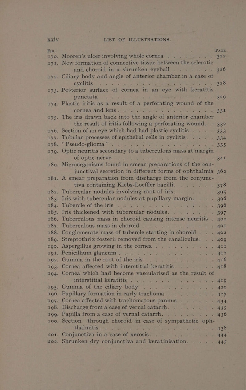 pre. 170. TV I. 172: ZO 202. Mooren’s ulcer involving whole cornea . New formation of connective tissue between ne Eleronie and choroid in a shrunken eyeball Ciliary body and AES of anterior chamber.in a case Poe cyclitis punctata cornea and lens. the result of iritis following a perforating wound. of optic nerve junctival secretion in different forms of ophthalmia tiva containing Klebs-Loeffler bacilli. interstitial keratitis . thalmitis. Conjunctiva in a case aE xXerosis. Shrunken dry conjunctiva and Pere ini ea 341 378 395 397 400 401 402 409 ip Gil 412 A116 A418 419 420 427 434 435 436 438 444 445