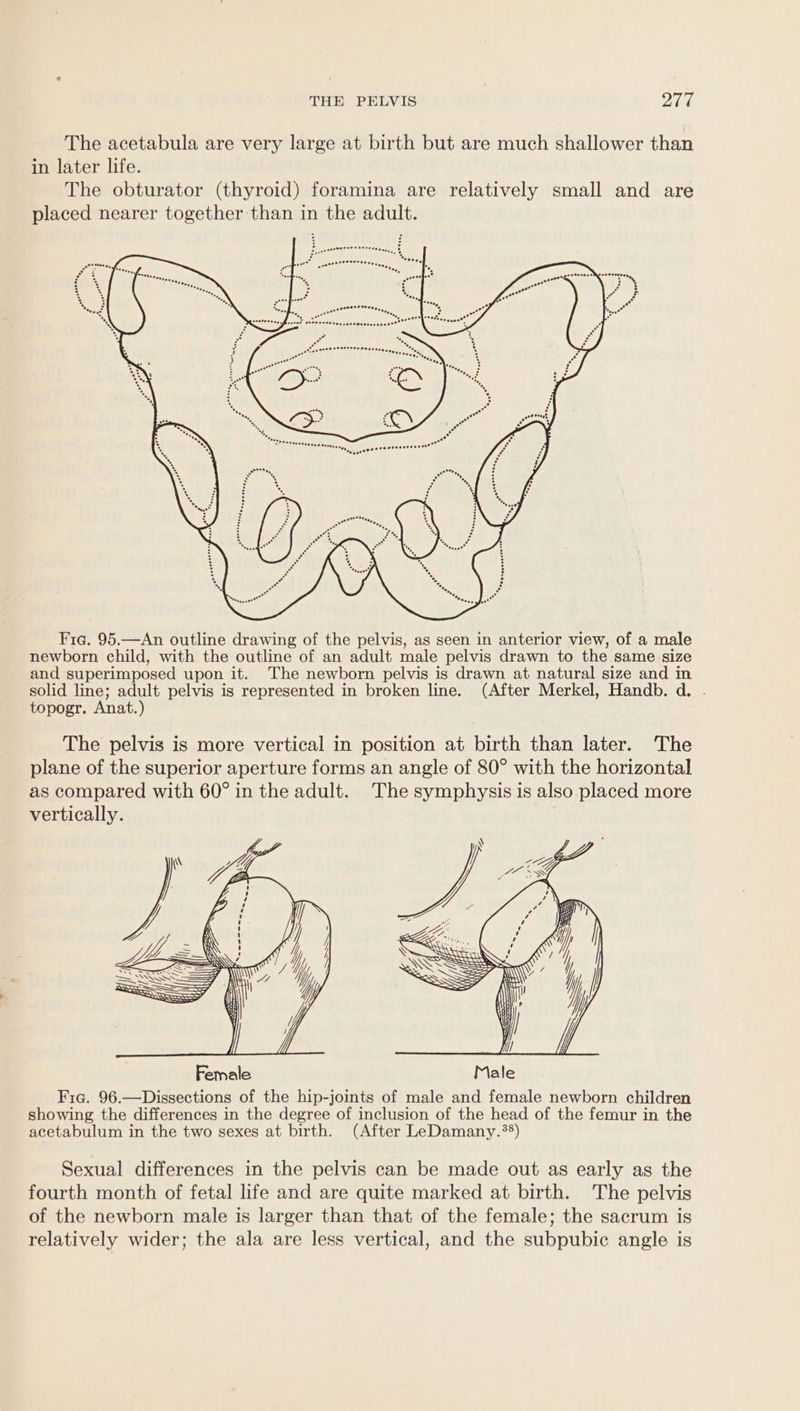 The acetabula are very large at birth but are much shallower than in later life. The obturator (thyroid) foramina are relatively small and are placed nearer together than in the adult. Fre. 95.—An outline drawing of the pelvis, as seen in anterior view, of a male newborn child, with the outline of an adult male pelvis drawn to the same size and superimposed upon it. The newborn pelvis is drawn at natural size and in solid line; adult pelvis is represented in broken line. (After Merkel, Handb. d. topogr. Anat.) The pelvis is more vertical in position at birth than later. The plane of the superior aperture forms an angle of 80° with the horizontal as compared with 60° in the adult. The symphysis is also placed more vertically. Sexual differences in the pelvis can be made out as early as the fourth month of fetal life and are quite marked at birth. The pelvis of the newborn male is larger than that of the female; the sacrum is relatively wider; the ala are less vertical, and the subpubic angle is