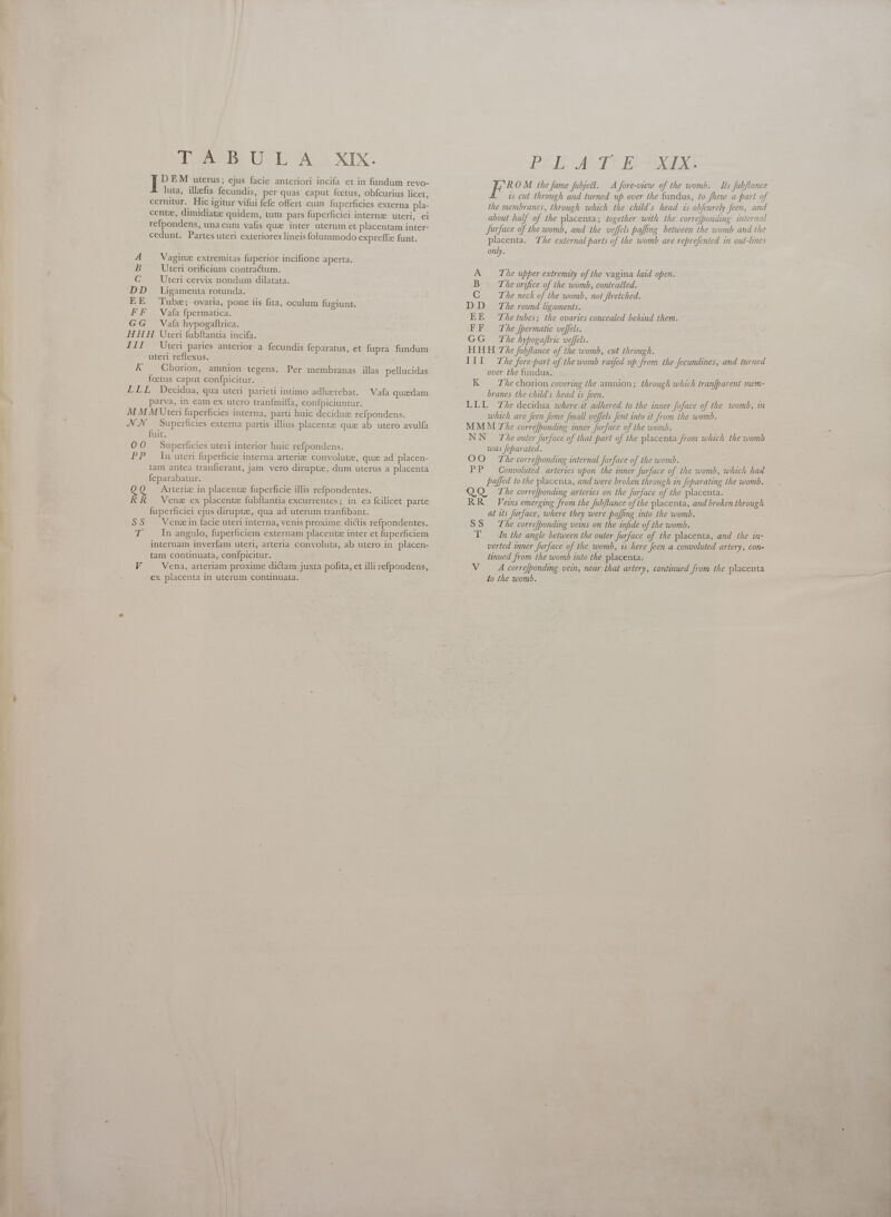 c —————s TABULA XIX. I^ EM uterus; ejus facie anteriori incifa et in fundum revo- luta, illefis fecundis, per quas caput foetus, obfcurius licet, cernitur. Hic igitur vifui fefe offert cum fuperficies externa pla- centze, dimidiatze quidem, tum pars fuperficiei interne uteri, ei refpondens, una cum vafis que inter uterum et placentam inter- cedunt. Partes uteri exteriores lineis folummodo expreffz funt. 4 Vaginze extremitas fuperior incifione aperta. EE Tube; ovaria, pone iis fita, oculum fugiunt. FF Vafafpermatica. GG Vafa hypogaftrica. HHA Uteri fubftantia incifa. III Uter paries anterior a fecundis feparatus, et fupra fundum uteri reflexus. K Chorion, amnion tegens. Per membranas illas pellucidas foetus caput confpicitur. LLL Decidua, qua uteri parieti intimo adherebat. Vafa quzedam parva, in eam ex utero tranfmiffa, confpiciuntur. M M MUteri fuperficies interna, parti huic deciduz refpondens. NN Superficies externa partis illius placentz qua ab utero avulfa fuit, OO Superficies uteri interior huic refpondens. PP In uteri fuperficie interna arteriz convolute, quz ad placen- tam antea tranfierant, jam vero dirupte, dum uterus a placenta feparabatur. ; QQ Arteriz in placentz fuperficie illis refpondentes. RR Venz ex placente fubftantia excurrentes; in ea fcilicet parte fuperficiei ejus diruptz, qua ad uterum tranfibant. SS Venez in facie uteri interna, venis proxime dictis refpondentes. a In angulo, fuperficiem externam placentz inter et fuperficiem internam inverfam uteri, arteria convoluta, ab utero in placen- tam continuata, confpicitur. ex placenta in uterum continuata. PEZ ARTE Es of OM the fame fubject. A fore-view of the womb. Its fubflance ws cut through and turned up over the fundus, to fhew a part of the membranes, through which the child's head 1s obfcurely feen, and about half of the placenta; together with the correfponding internal Jurface of the womb, and the veffcls paffing between the womb and the placenta. The external parts of the womb are reprefented in out-lines only. FF The fpermatic veffels. GG The hypogaftric veffels. HHH The fubflance of the womb, cut through. III The fore-part of the womb raifed up from the Jecundines, and turned over the fundus. K The chorion covering the amnion; through which tranfparent mem- branes the child's head is feen. LLL The decidua where it adhered to the inner fuface of the womb, in which are feen fome fmall veffels fent into tt from the womb. MMM The corre[bonding inner Jurface of the womb. NN _ The outer furface of that part of the placenta from which the womb was feparated. OO The correfponding internal furface of the womb. PP JConvoluted arteries upon the inner Jurface of the womb, which had paffed to the placenta, and were broken through in feparating the womb. OQ. Lhe corre[bonding arteries on the furface of the placenta. RR_ Veins emerging from the fubflance of the placenta, and broken through at its furface, where they were paffing into the womb. SS The correfponding veins on the infide of the womb. i In the angle between the outer furface of the placenta, and the in- verted inner furface of the womb, is here Jeen a convoluted artery, con- tinued from the womb into the placenta. to the womb. 