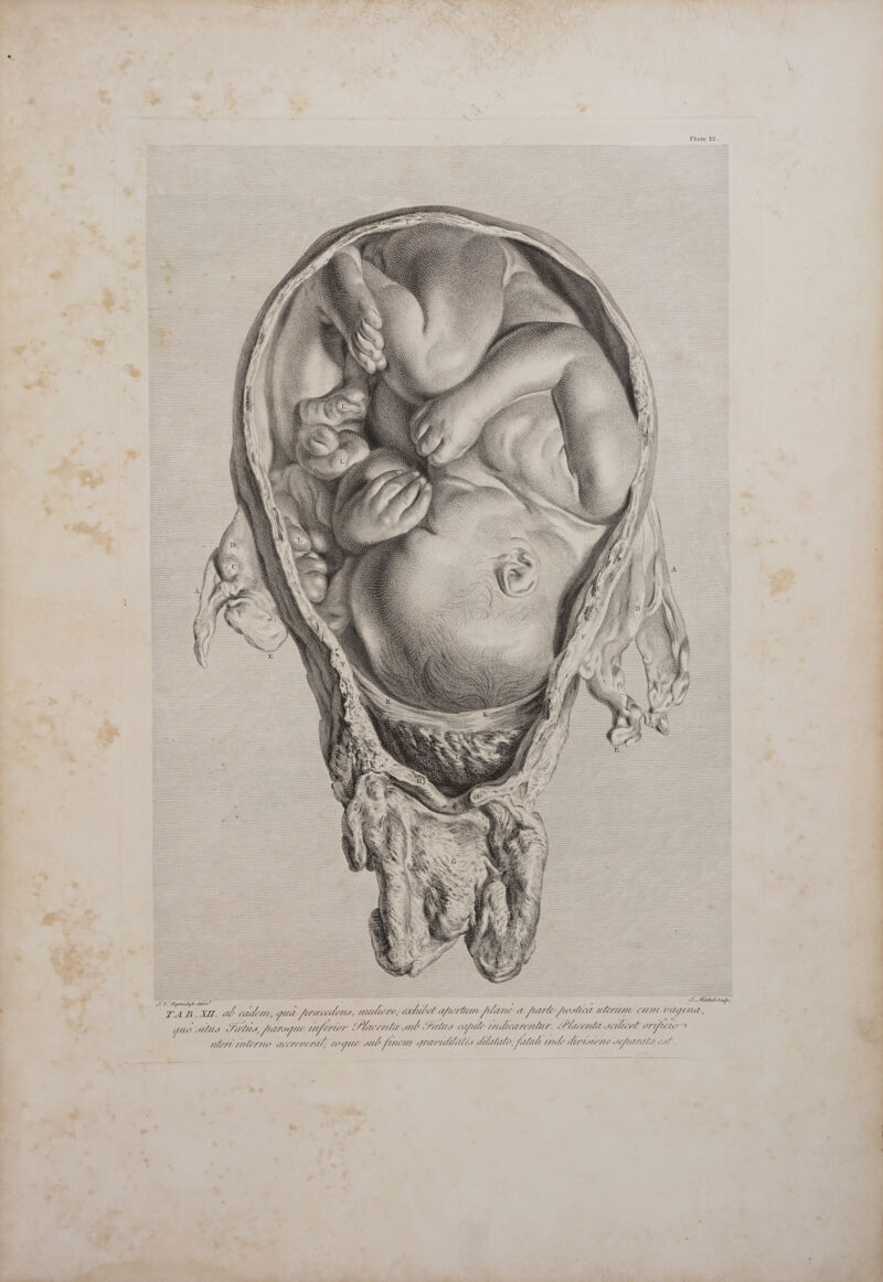    Plate 12. A d ip Miser    TN. Mna delim I. Michel Soup, TAB. XM. al cailem, quet farce, nulicre, cahiel apirtum Mene a fare ottica HPPIUTA CUM Hen, 4 . c. 4 ’ . “as j) ! 7 2 . . . 3 4 apie a 6 guo AMUd SCM, [rape eppfereent Piacente sil Fels cafe rniliarventur. Placenta s0ilicel or. filo alert untermo ucreveral: Coyle wl fenem gravidldidlis Mala, fulali ute MAMONE anfutnatat ea . ay do^ ne &gt; 