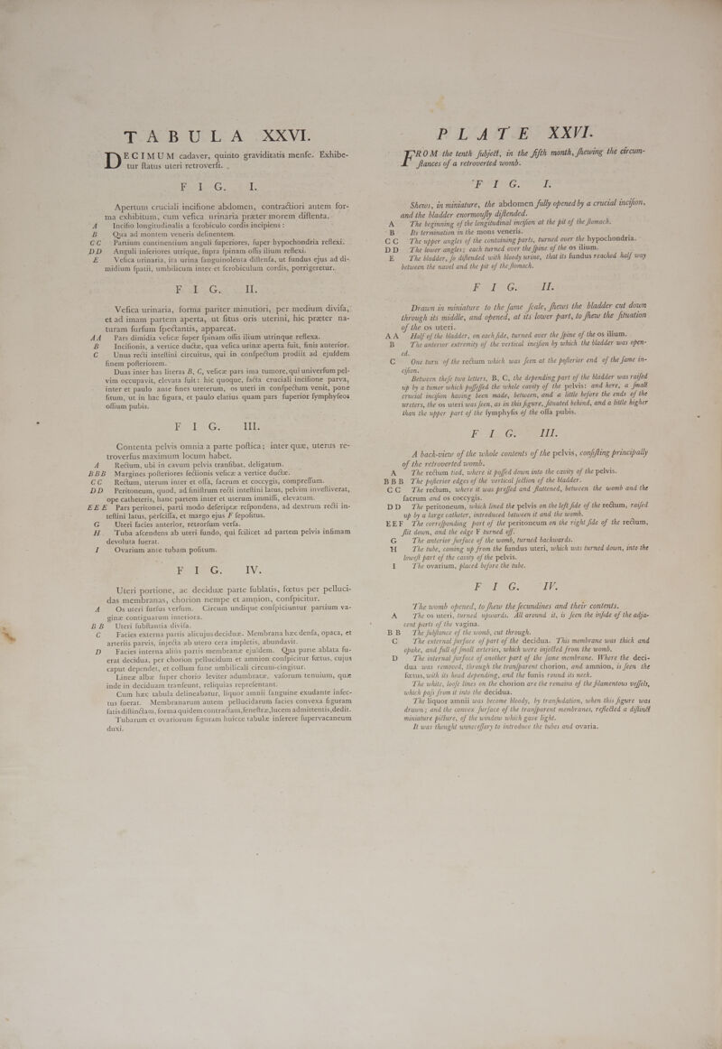 p» A ULE AW SXXVL ECIMUM cadaver, quinto graviditatis menfe. Exhibe- tur flatus uteri retroverfi. . Pole G, I. Apertum cruciali incifione abdomen, contractiori autem for- ma exhibitum, cum vefica urinaria preter morem diftenta. A Incifio longitudinalis a fcrobiculo cordis incipiens : B Qua ad montem veneris definentem. CC Partium continentium anguli fuperiores, fuper hypochondria reflexi. DD Anguli inferiores utrique, fupra fpinam.offis ilium reflexi. E Vefica urinaria, ita urina fanguinolenta diftenfa, ut fundus ejus ad di- midium fpatii, umbilicum inter et fcrobiculum cordis, porrigeretur. aby Gas vell. Vefica urinaria, forma pariter minutiori, per medium divifa, et ad imam partem aperta, ut fitus oris uterini, hic preter na- turam furfum fpectantis, appareat. Pars dimidia vefice fuper fpinam offis ilium utrinque reflexa. Incifionis, a vertice ductz, qua vefica urinz aperta fuit, finis anterior. finem pofteriorem. Duas inter has literas B, C, vefice pars ima tumore, qui univerfum pel- vim occupavit, elevata fuit: hic quoque, facta cruciali incifione parva, inter et paulo ante fines ureterum, os uteri in confpectum venit, pone fitum, ut in hac figura, et paulo elatius quam pars fuperior fymphyfeos offium pubis. 6 tyne Iob G: III. Contenta pelvis omnia a parte poftica; inter quz, uterus re- troverfus maximum locum habet. A Rectum, ubi in cavum pelvis tranfibat, deligatum. BBB Margines polleriores feclionis vefica a vertice ducte. CC Re&amp;um, uterum inter et offa, facrum et coccygis, compreflum. DD Peritoneum, quod, ad finiftrum recü inteflini latus, pelvim inveftiverat, ope catheteris, hanc partem inter et uterum immifífi, elevatum. EEE Pars peritonei, parti modo deferipte refpondens, ad dextrum recti in- teftini latus, perfcilla, et margo ejus F fepofitus. G Uteri facies anterior, retrorfum verfa. H. Tuba afcendens ab uteri fundo, qui fcilicet ad partem pelvis infimam devoluta fuerat. I Ovarium ante tubam pofitum. DUNG. LY: Uteri portione, ac deciduze parte fublatis, foetus per pelluci- das membranas, chorion nempe et amnion, confpicitur. A Os uteri furfus verfum. Circum undique confpiciuntur partium va- gine contiguarum interiora. BB Uteri fubftantia divifa. C Facies externa partis alicujus deciduzs. Membrana hac denfa, opaca, et arteriis parvis, injecla ab utero cera impletis, abundavit. D Facies interna aliüs partis membranz ejuidem. Qua parte ablata fu- erat decidua, per chorion pellucidum et amnion confpicitur fcetus, cujus caput dependet, et collum fune umbilicali circum-cingitur. Linez albx fuper chorio leviter adumbratz, vaforum tenuium, qua inde in deciduam tranfeunt, reliquias reprefentant. Cum hzc tabula delineabatur, liquor amnii fanguine exudante infec- tus fuerat. Membranarum autem pellucidarum facies convexa figuram fatisdiflinctam, forma quidem contractam, feneftrz,lucem admittentis,dedit. Tubarum et ovariorum figuram huicce tabule inferere fupervacaneum duxi. PLA WT UES XXVE. ROM the tenth fubjett, in the fifth month, fhewing the circum- lances of a retroverted womb. AU cot n Shews, in miniature, the abdomen fully opened by a crucial incifion, and the bladder enormoujly diftended. A The beginning of the longitudinal incifion at the pit of the flomach. B Its termination in the mons veneris. CC The upper angles of the containing parts, turned over the hypochondria. : DD ZAÀelower angles; each turned over the [pine of the os ilium. E The bladder, fo diflended with bloody urine, that its fundus reached half way between the navel and the pit of the flomach. Teen 6i 1I. Drawn 4n miniature to the fame cale, fhews the bladder cut down through its middle, and opened, at tts lower part, to few the fituation of the os uteri. AA Half of the bladder, on each fide, turned over the {pine of the os ilium. B The anterior. extremity of the vertical incifion by which the bladder was open- C One turn of the reum which was feen at the poflerior end of the fame in- cifton. Between. thefe two letters, B, C, the depending part of the bladder was raifed up by a tumor which poffeffed the whole cavity of the pelvis: and here, a [mall crucial incifion having been made, between, and a little before the ends of the ureters, the os uteri was feen, as in this figure, fituated behind, and a little higher than the upper part of the fymphyfis of the offa pubis. Ew III. A back-view of the whole contents of the pelvis, confi/ting principally of the retroverted womb. A The re&amp;um tied, where it paffed down into the cavity of the pelvis. BBB The poflerior edges of the vertical fection of the bladder. CC The reum, where it was preffed and flattened, between the womb and the facrum and os coccygis. DD The peritoneum, which lined the pelvis on the left fide of the rectum, raifed up by a large catheter, introduced between it and the womb. EEF The corre/ponding part of the peritoneum on the right fide of the rectum, Slit down, and the edge F turned off. G The anterior furface of the womb, turned backwards. H The tube, coming up from the fundus uteri, which was turned down, into the lowefl part of the cavity of the pelvis. I The ovarium, placed before the tube. TS IV. The womb opened, to fhew the fecundines and their contents. A The os uteri, turned upwards. All around it, is een the infide of the adja- cent parts of the vagina. BB Zhe fubflance of the womb, cut through. C The external furface of part of the decidua. This membrane was thick and opake, and full of [mall arteries, which were injected from the womb. D The internal furface of another part of the fame membrane. Where the deci- dua was removed, through the tranfparent chorion, and amnion, zs feen the foetus, with its head depending, and the funis round its neck. The white, loofe lines on the chorion are the remains of the filamentous veffels, which pa[s from it into the decidua. The liquor amnii was become bloody, by tranfudation, when this figure was drawn ; and the convex furface of the tran[parent membranes, reflected a diftind miniature picture, of the window which gave light. It was thought unneceffary to introduce the tubes and ovaria. 