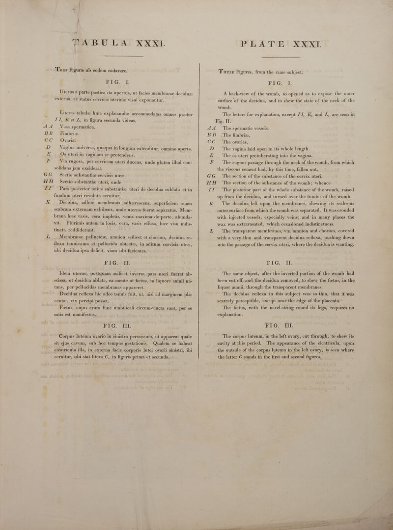 - TABULA XXXI.  Tres Figura ab eodem cadavere. PRG I. Uterus a parte postica ita apertus, ut facies membrane deciduze externa, ac status cervicis uterinz visui exponantur. Literas tabulae huie explanandz accommodatas omnes praeter Il, Ket L, in figura secunda videas. AA Vasa spermatica. BB Fimbrie. CC Qvaria. D Vagina universa, quaqua in longum extenditur, omnino aperta. E . Os uteri in vaginam se protendens. F Via rugosa, per cervicem uteri ducens, unde gluten illud con- solidans jam exciderat. GG Sectio substantiz cervicis uteri. HH Sectio substantia uteri, unde TI Pars posterior totius substantia; uteri de decidua sublata et in fundum uteri revoluta cernitur. K Decidua, adhuc membranis adhzrescens, superficiem suam scabram externam exhibens, unde uterus fuerat separatus. Mem- brana haec vasis, cera impletis, venis maxima de parte, abunda- vit. Plurimis autem in locis, cera, vasis effusa, hae visu indis- tincta reddiderunt. if Membrane pellucidz, amnion scilicet et chorion, decidua re- flexa tenuissima et’ pellucida obtectz, in aditum cervicis. uteri, ubi decidua ipsa deficit, viam sibi facientes. FIGs clk; Idem uterus; postquam scilicet inversa pars uteri fuerat ab- scissa, et decidua ablata, ea mente ut foetus, in liquore amnii na- tans, per pellucidas membranas appareret. Decidua reflexa hic adeo tenuis fuit, ut, nisi ad marginem pla- cente, vix percipi posset. . Feetus,. cujus crura fune umbilicali cireum-vincta sunt, per se satis est manifestus. BEG. ott, Corpus luteum ovario in sinistro perscissum, ut appareat quale sit ejus cavum, sub hoc tempus gestationis. Qualem se habeat cicatricula illa, in externa facie corporis lutei ovarii sinistri, ibi cernitur, ubi stat litera C, in figuris prima et secunda. 9 PLATE XXXI 'Tunzzr Figures, from the same subject. IU TL. A back-view of the womb, so opened as to expose the outer surface of the decidua, and to shew the state of the neck of the womb. The letters for explanation, except IJ, K, and L, are seen in Pig, IL. AA The spermatic vessels. BB The fimbrie. CC The ovaries. D The vagina laid open in its whole length. E The os uteri protuberating into the vagina. F The rugous passage through the neck of the womb, from which the viscous cement had, by this time, fallen out. GG The section of the substance of the cervix uteri. HH The section of the substance of the womb; whence II ‘The posterior part of the whole substance of the womb, raised up from the decidua, and turned over the fundus of the womb. K The decidua left upon the membranes, shewing its scabrous outer surface from which the womb was separated. It was crouded with injected vessels, especially veins; and in many places the wax was extravasated, which occasioned indistinctness. L The transparent membranes, viz. amnion and chorion, covered with a very thin and transparent decidua reflexa, pushing down into the passage of the cervix uteri, where the decidua is wanting. I LGB The same object, after the inverted portion of the womb had been cut off, and the decidua removed, to shew the foetus, in the liquor amnii, through the transparent membranes. The decidua reflexa in this subject was so thin, that it was scarcely perceptible, except near the edge of the placenta. The fetus, with the navel-string round its legs, requires no explanation. FIG. ITI. The corpus luteum, in the left ovary, cut through, to shew its cavity at this period. The appearance of the cicatricula, upon the outside of the corpus luteum in the left ovary, is seen where the letter C stands in the first and second figures. 