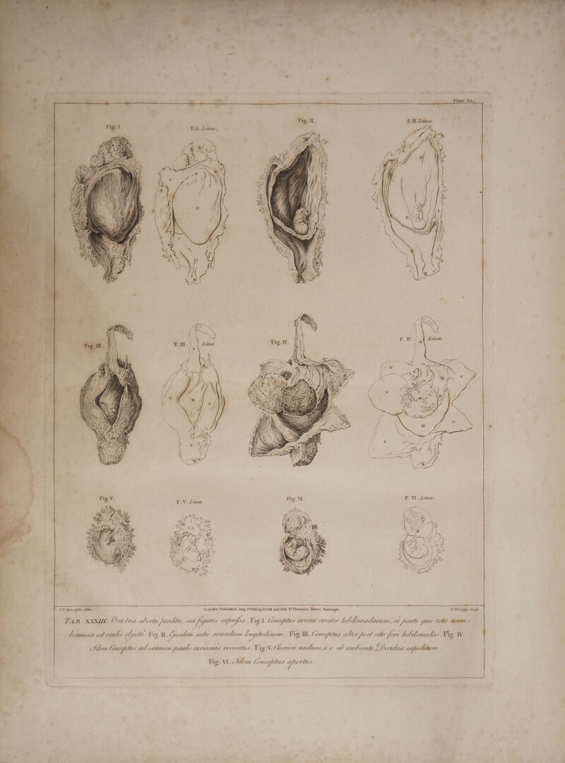           M v ito 8 Sus V) LP Ide S2 On SO | s $e. » X à 2M x 4 wit kta, g VE CM. - 225 &gt; E ovg tea Y DV x = 1K Rymuadyke deliv, London Published July 18'1815.by E.COX and SON, S'Thomas's Street, Borough . Tor ule Sculpe. ~ * jr E j? ] &gt; E id TAB. XXXI. Ova tria abortu Junta, ve faga at; fen Fig.l. Lowe otto novem etreetey Jdlealboaptetrttan, eet rte gua lott men - e D , 1 ; * ; ;  ; ‘ , x = a. Cramaced ost onte obj Vet. Fig. i, Gusdem vectto weuniliim lonupludinem : Fig: Ut. ( Once lite alter foot oclo fene Aeclidomidad. Fig. IV. A = A Co , i Idem Conciplics ad examen faute curtostts revovalis , Fig N. € Mormon. qutdum., t.e. abamnbunte Docidua eolit T Fig’. VI. « Idem Conceplits gu « =    = T das