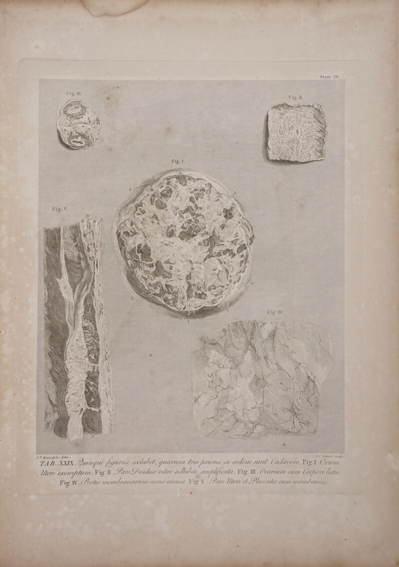 Plate 29. vl LER, dyhe Pe LC. Canot Souder. TAB, XXIX: Yungue / [ytd cahilel, qguarum Les frloves av com mine Cadavere. Fig t Ovum ee even fln. Fig Ary Deu’ vitro ude amplfuatt. Fig Il. COnauim cum lorpore Mileo. ‘i . « d 5 : e. ) P . ; : . Fig Ny aC Porto mer CYAQnwui WON0 WUNIE, Fig Vv. Piva ltere el Llacente cum MeNUTaNtd e pedlinday Piles